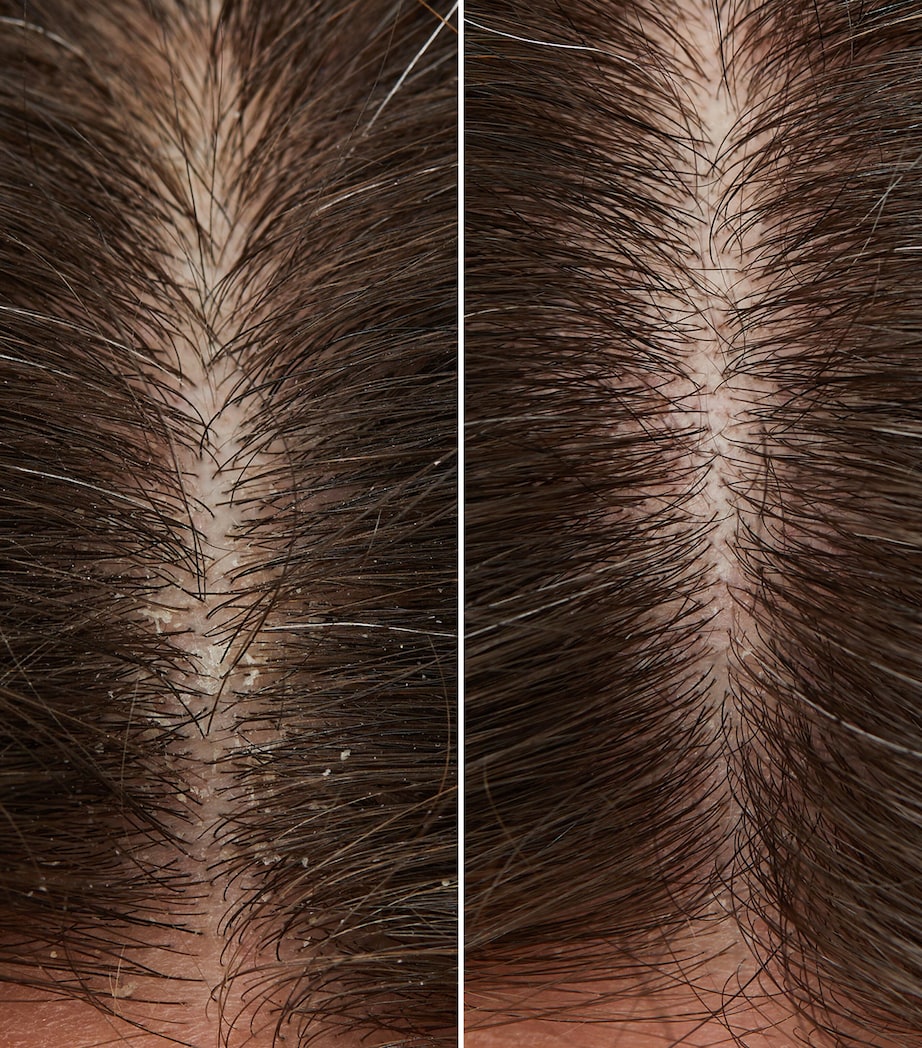 Flaky Itchy Scalp Hydrating Curl Shampoo (500ml) NO COLOUR Image 2