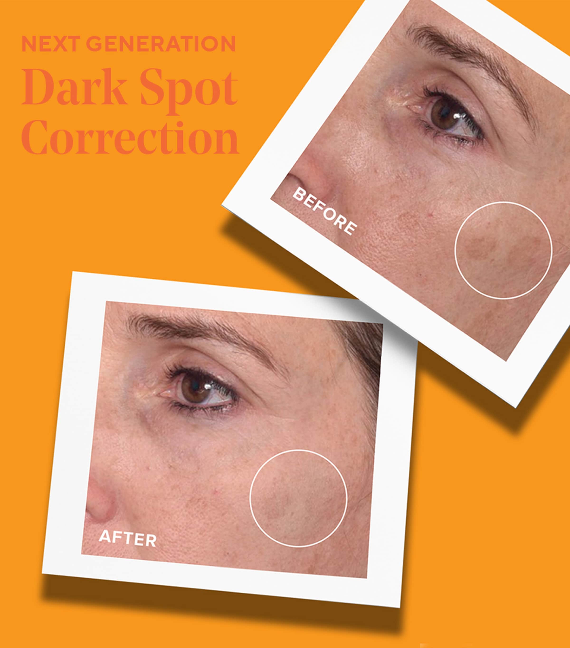 Rapid Dark Spot Correcting Serum (30ml) NO COLOUR Image 4