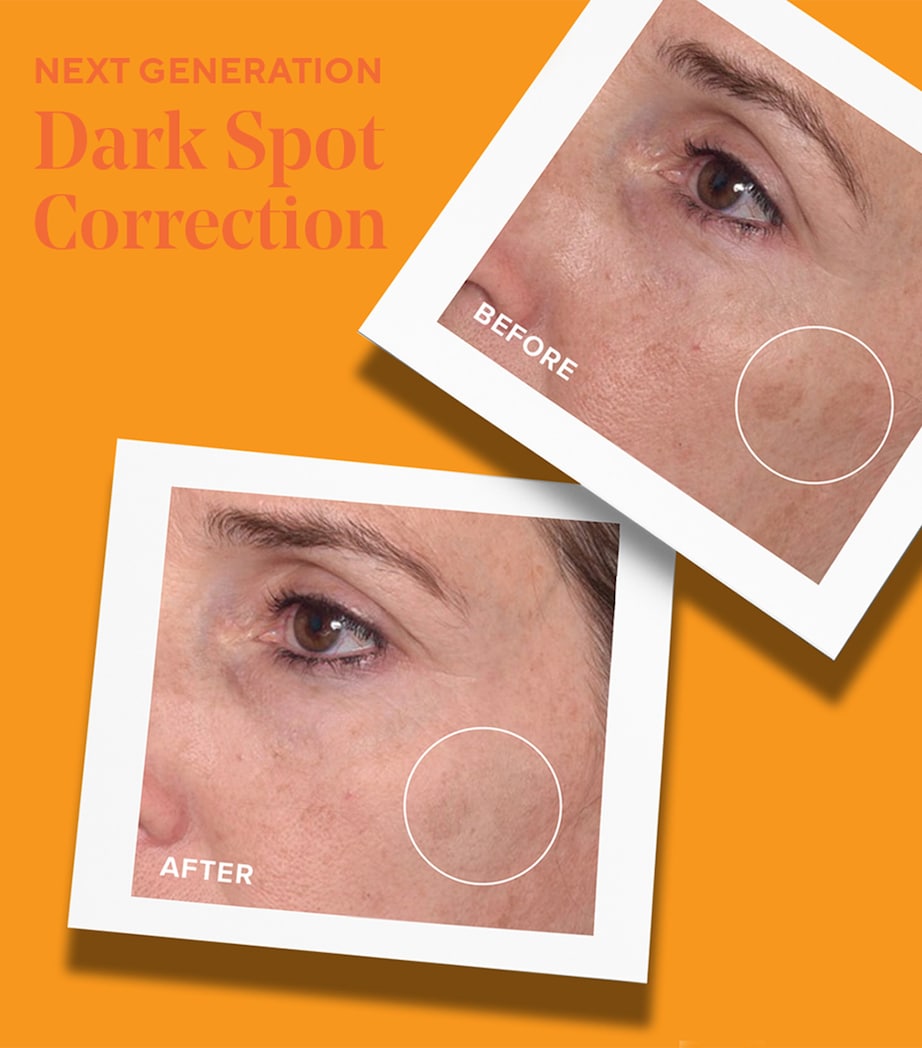 Rapid Dark Spot Correcting Serum (30ml) NO COLOUR Image 4