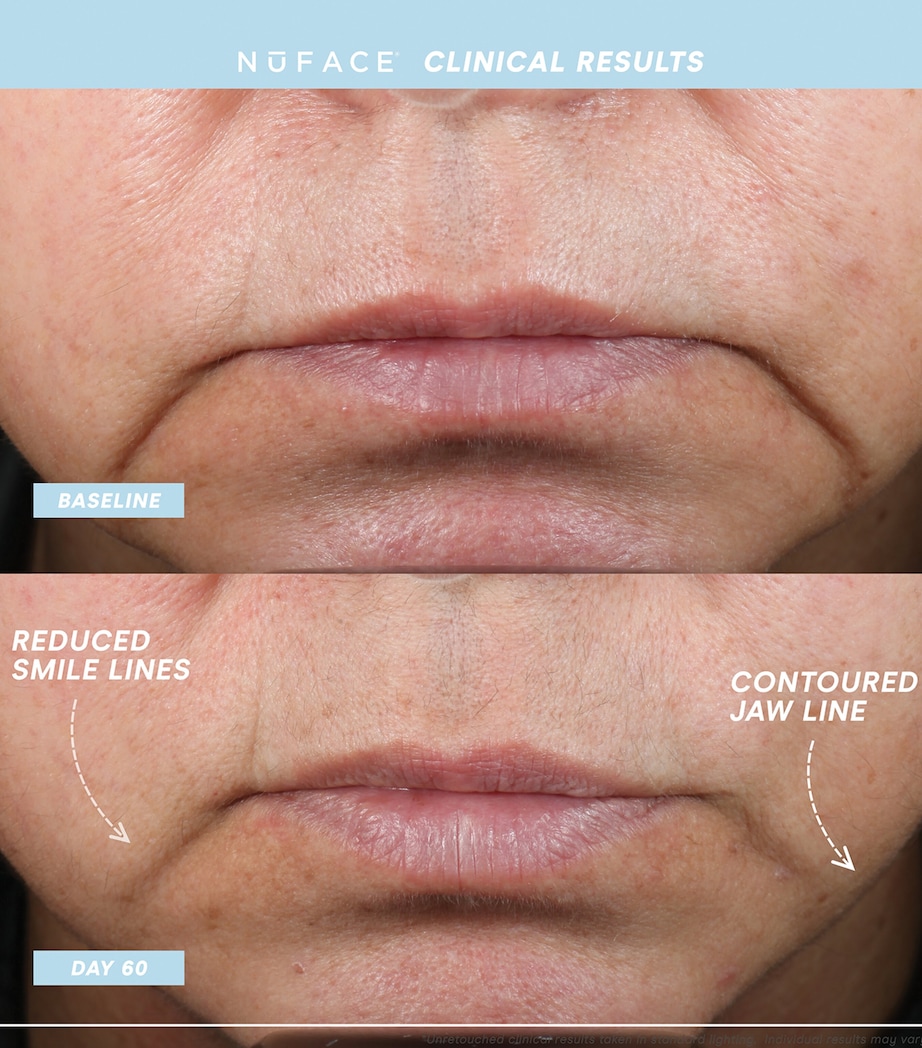 Mini+ Starter Kit NO COLOUR Image 4