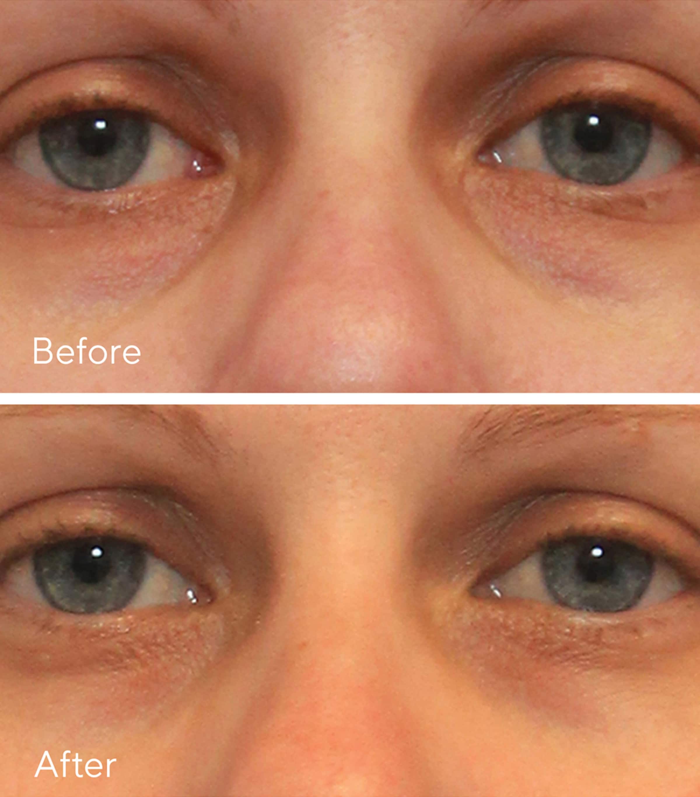 Vita-C Eyes Dark Circle Corrector (15Ml) NO COLOUR Image 2