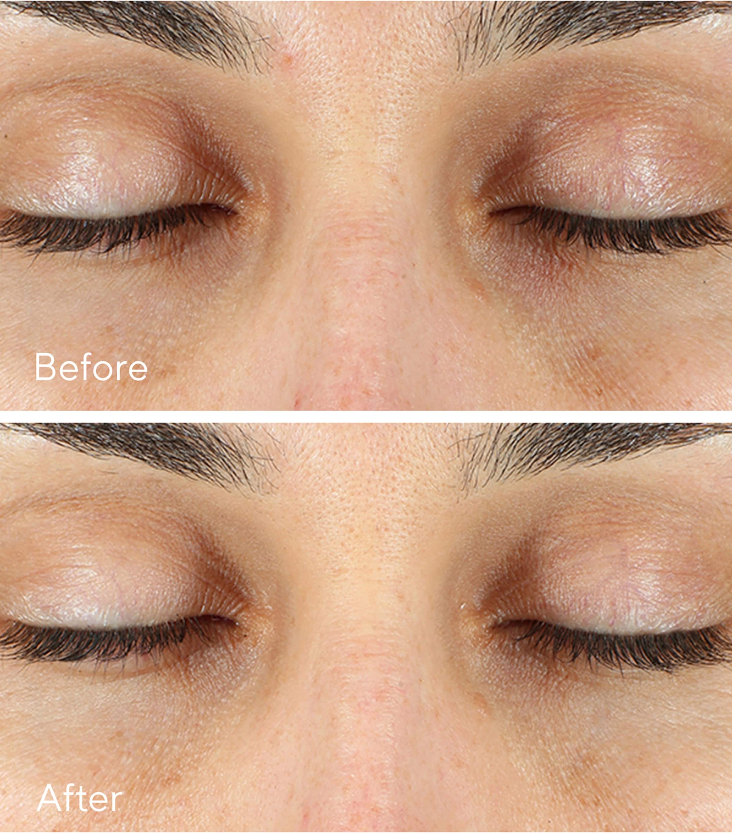 Vita-C Eyes Dark Circle Corrector (15Ml) NO COLOUR Image 3