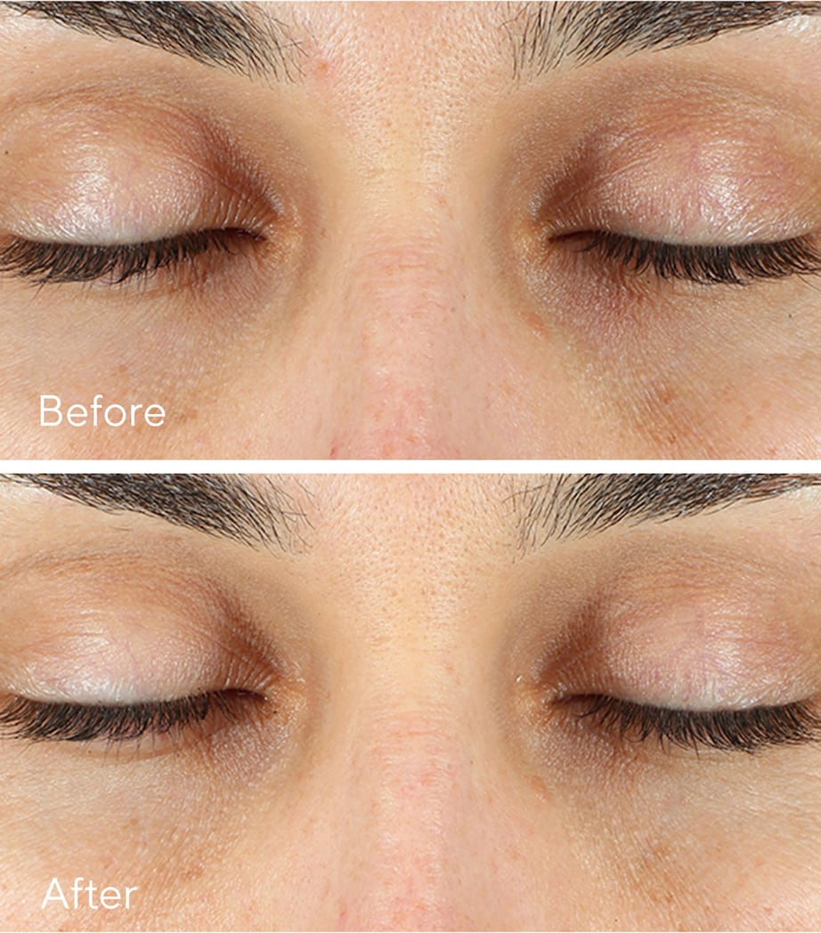 Vita-C Eyes Dark Circle Corrector (15Ml) NO COLOUR Image 3