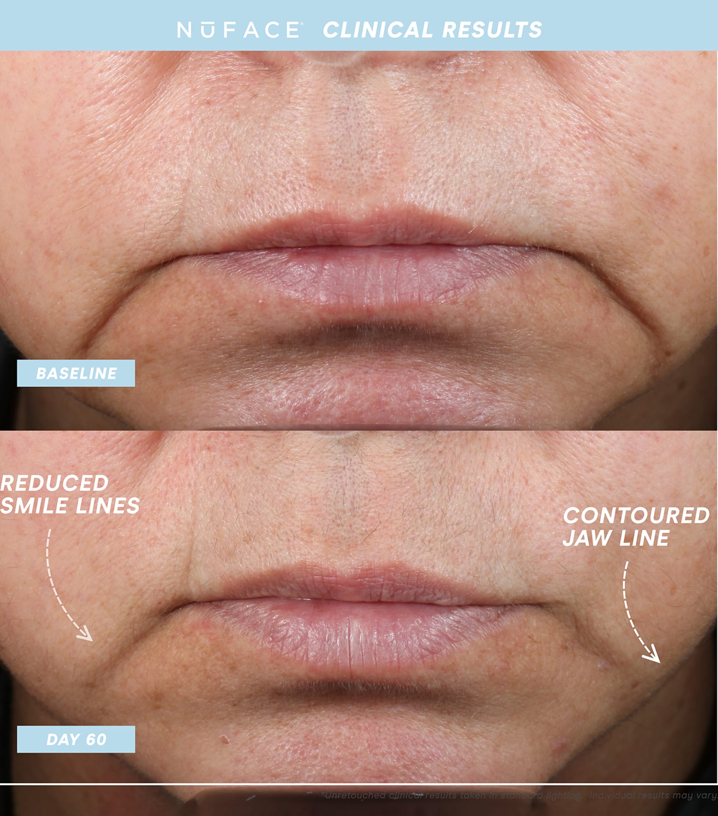 Trinity+ Eye and Lip Set NO COLOUR Image 5