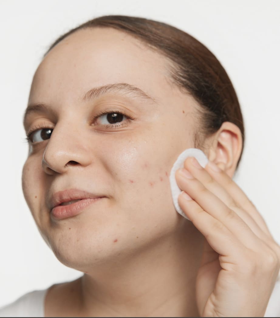 Skin School Supplies: Anti-Blemish Basics Gift Set NO COLOUR Image 3