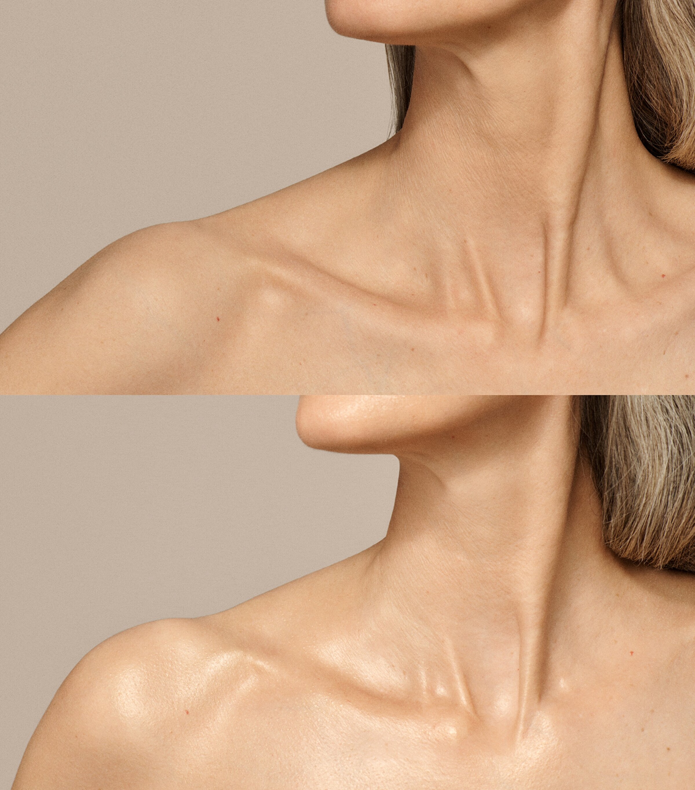 Skin Nova XL NO COLOUR Image 8