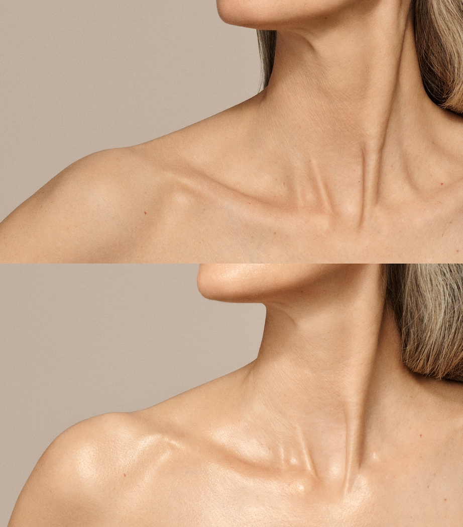 Skin Nova XL NO COLOUR Image 8