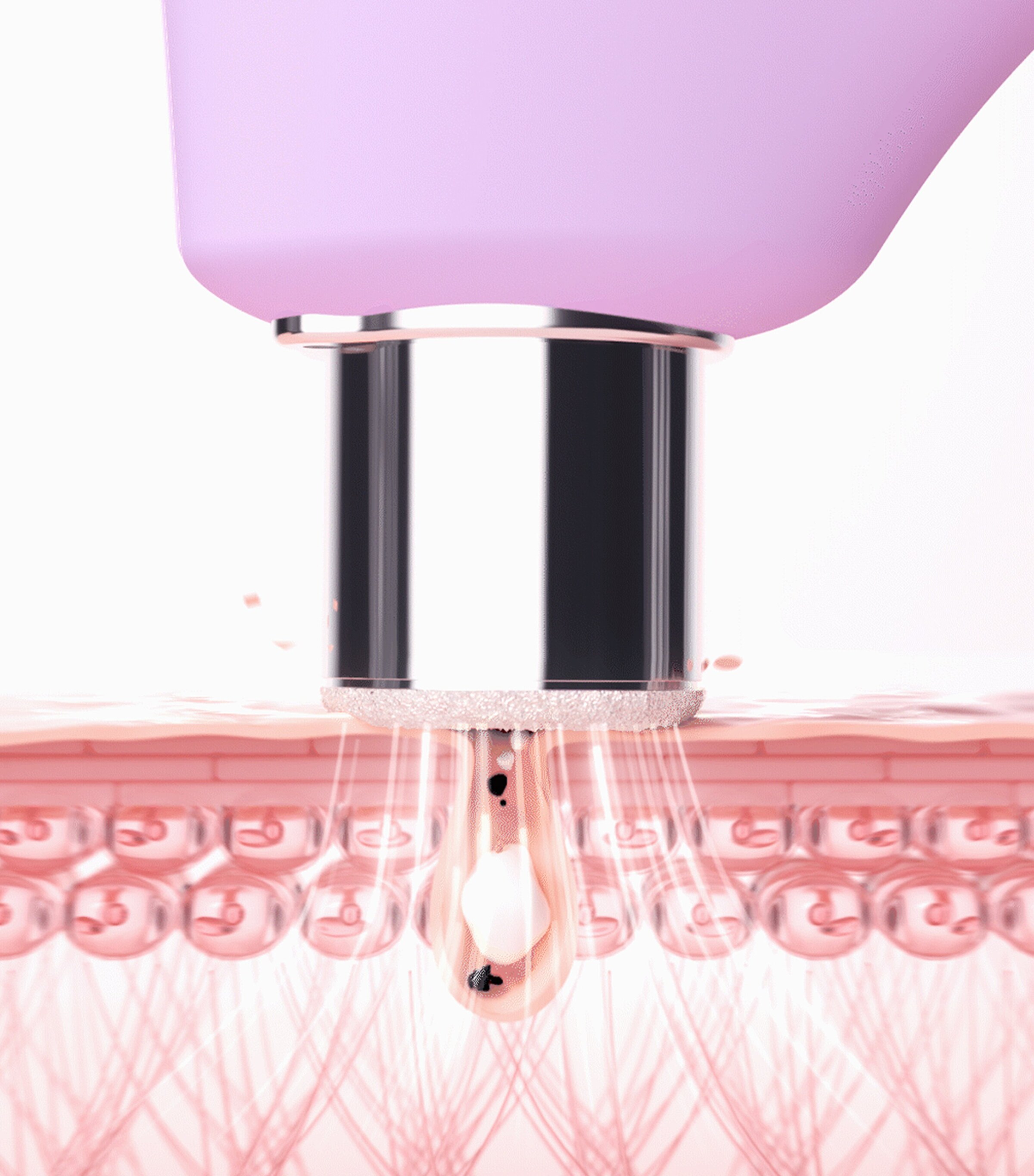 Foreo Kiwi Derma Diamond Microdermabrasion and Pore Vacuum Device Image 3