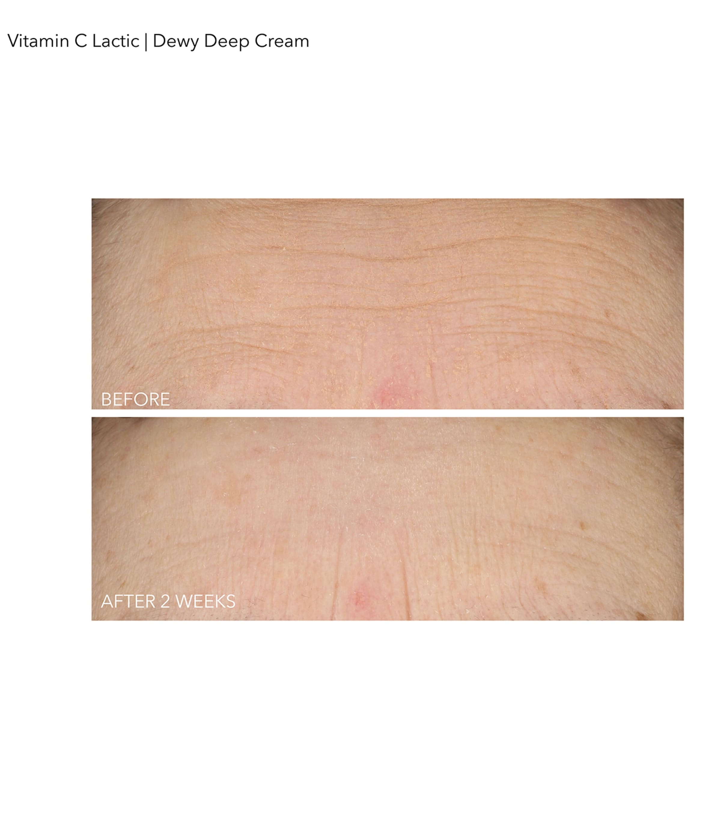 Vitamin C + Lactic Dewy Deep Cream (60ml) NO COLOUR Image 2