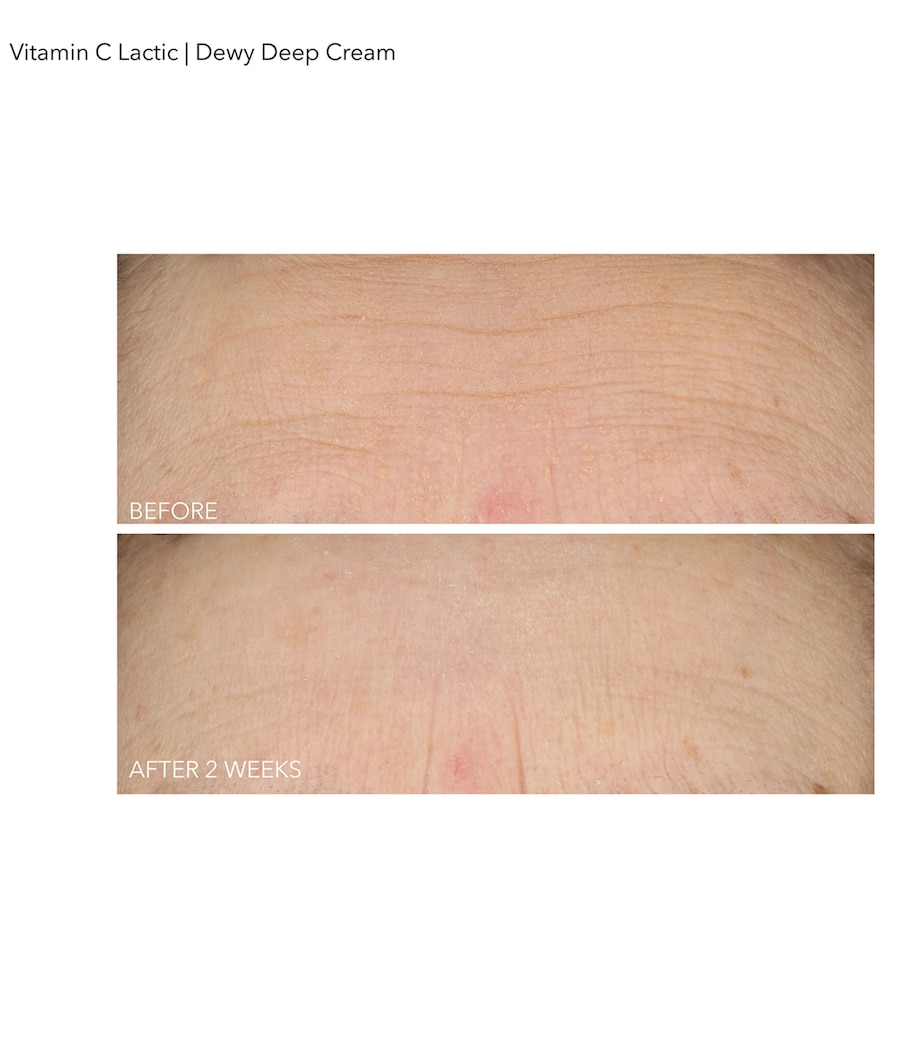 Vitamin C + Lactic Dewy Deep Cream (60ml) NO COLOUR Image 2
