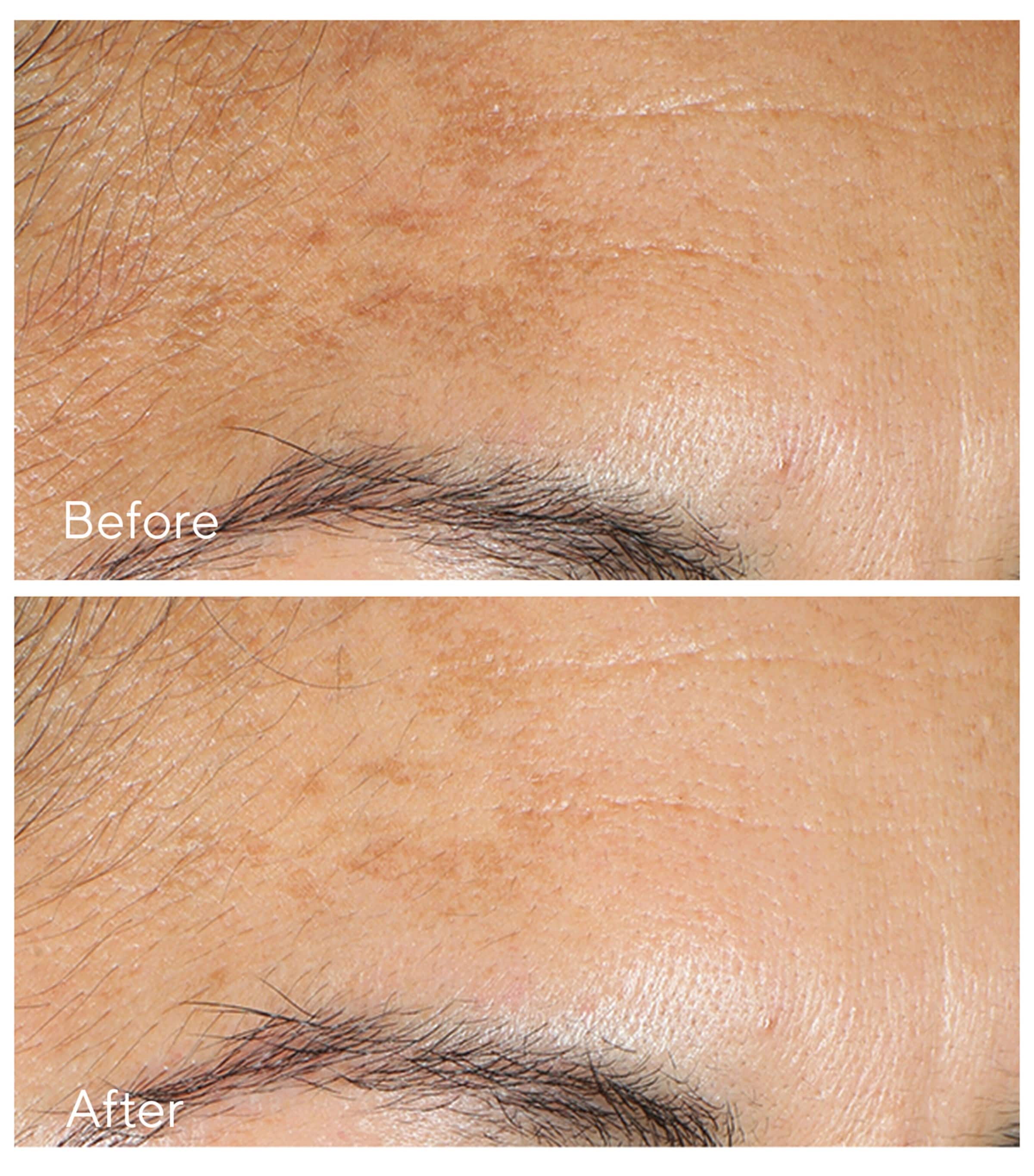 Vita C Glycolic Serum (30ml) NO COLOUR Image 2