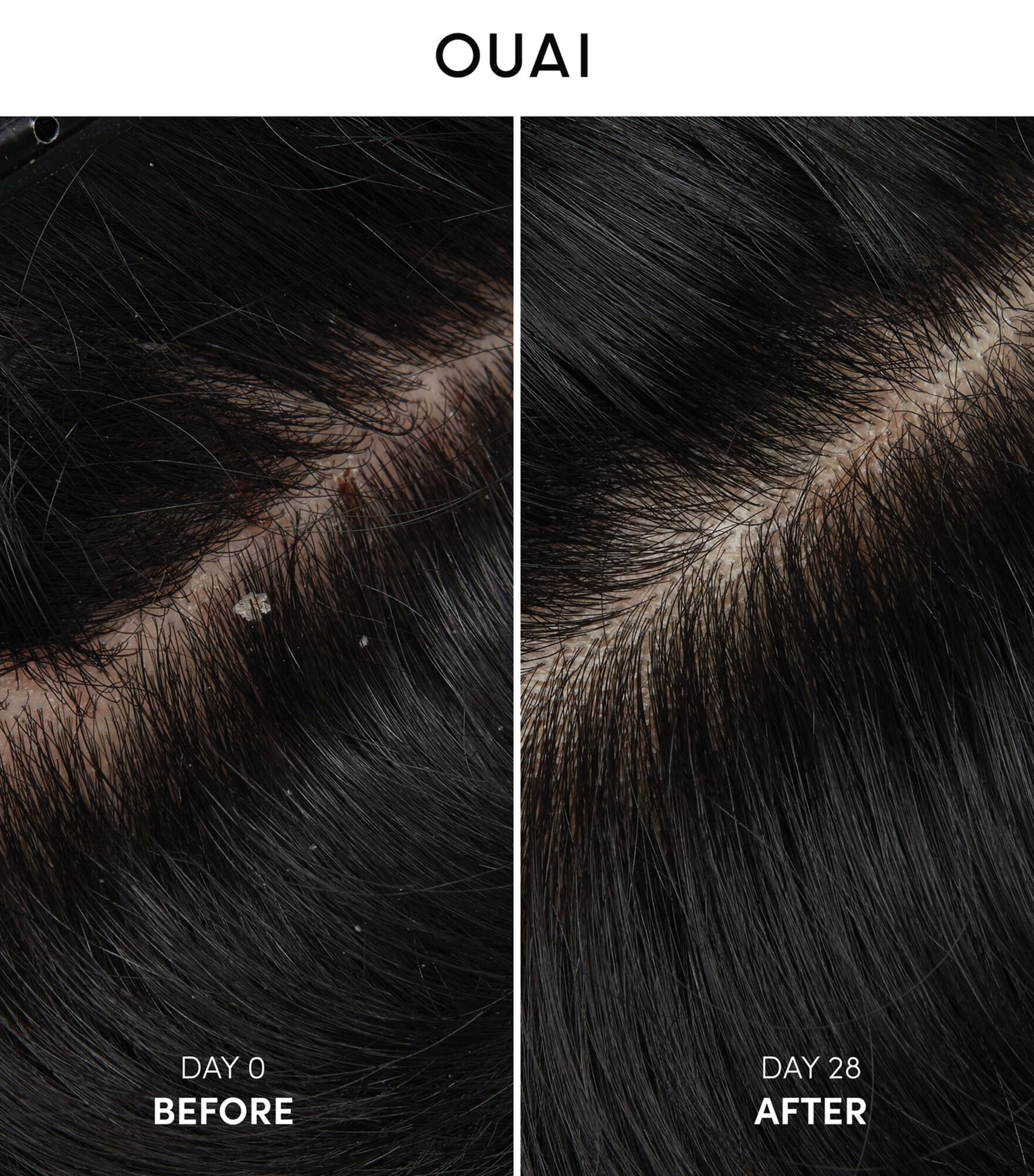 Anti-Dandruff Shampoo (300ml) NO COLOUR Image 6