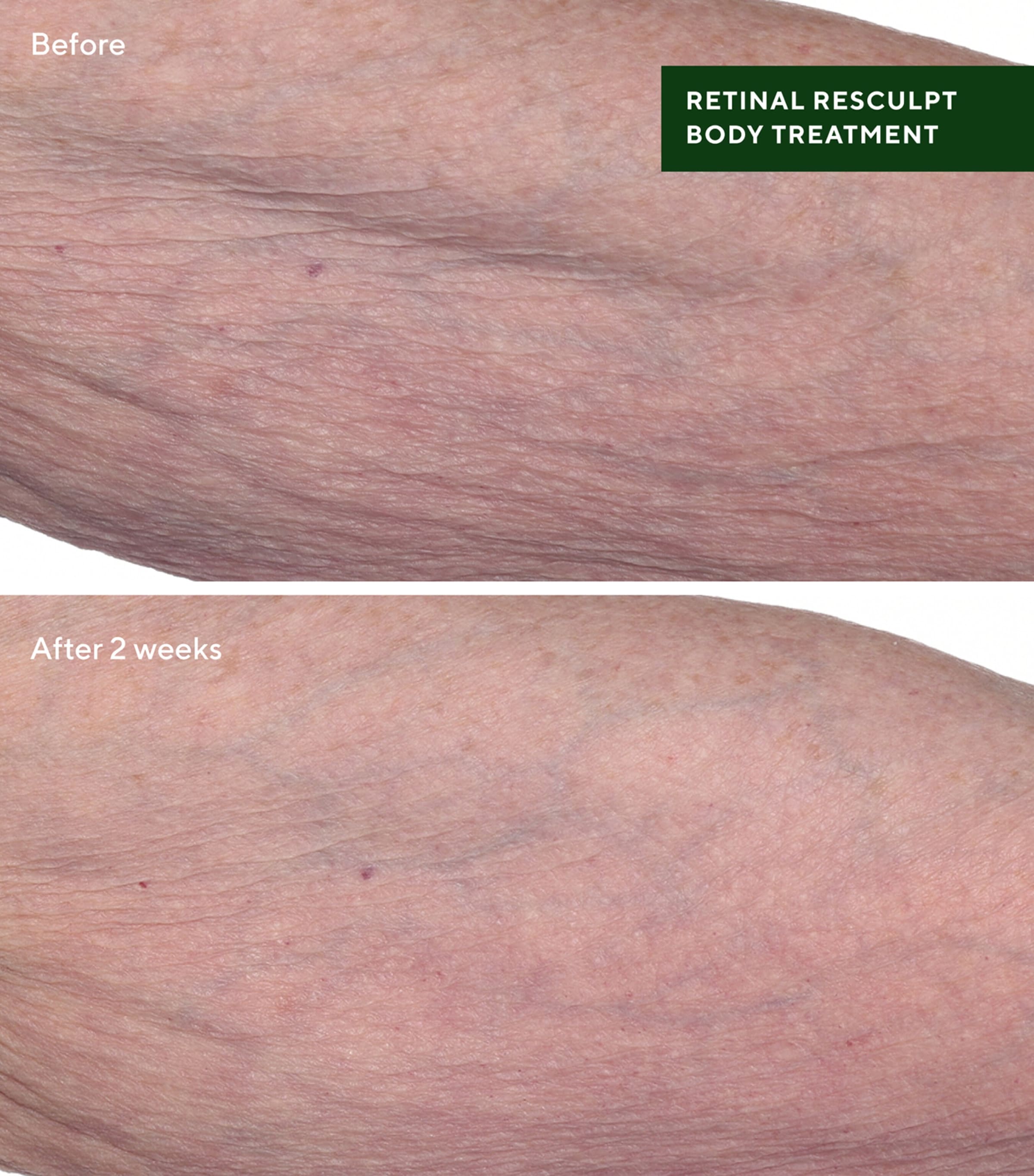 Retinal ReSculpt Body Treatment (148ml) RESURGENCE Image 3