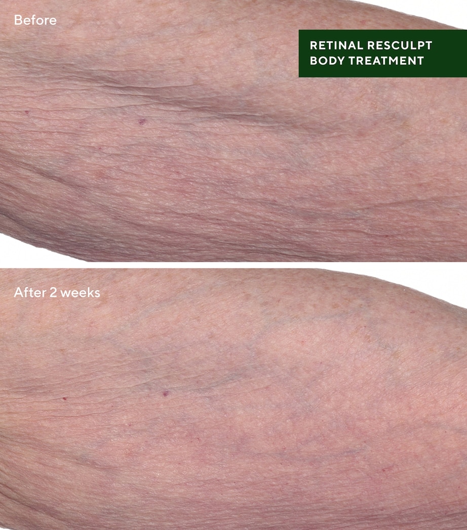 Retinal ReSculpt Body Treatment (148ml) RESURGENCE Image 3