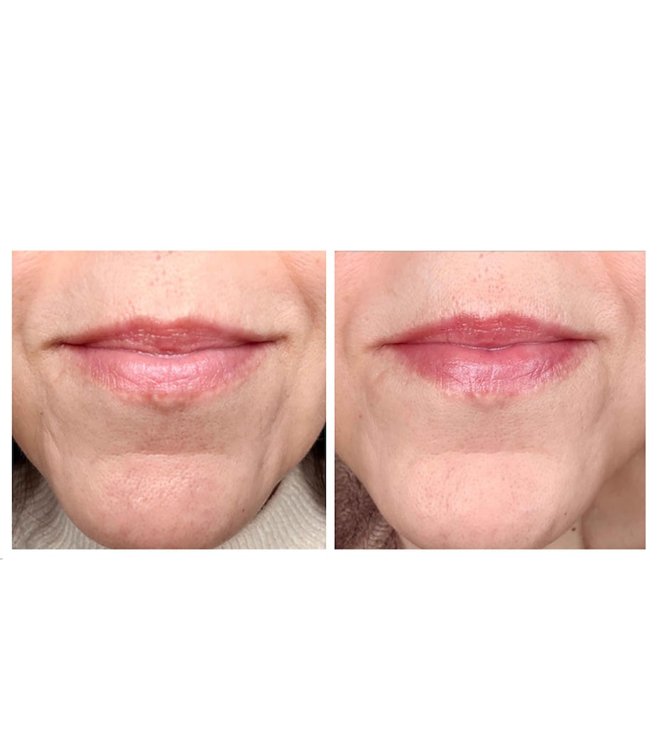 Shiseido Vital Perfection Intensive WrinkleSpot Treatment A+ (20ml) Image 2
