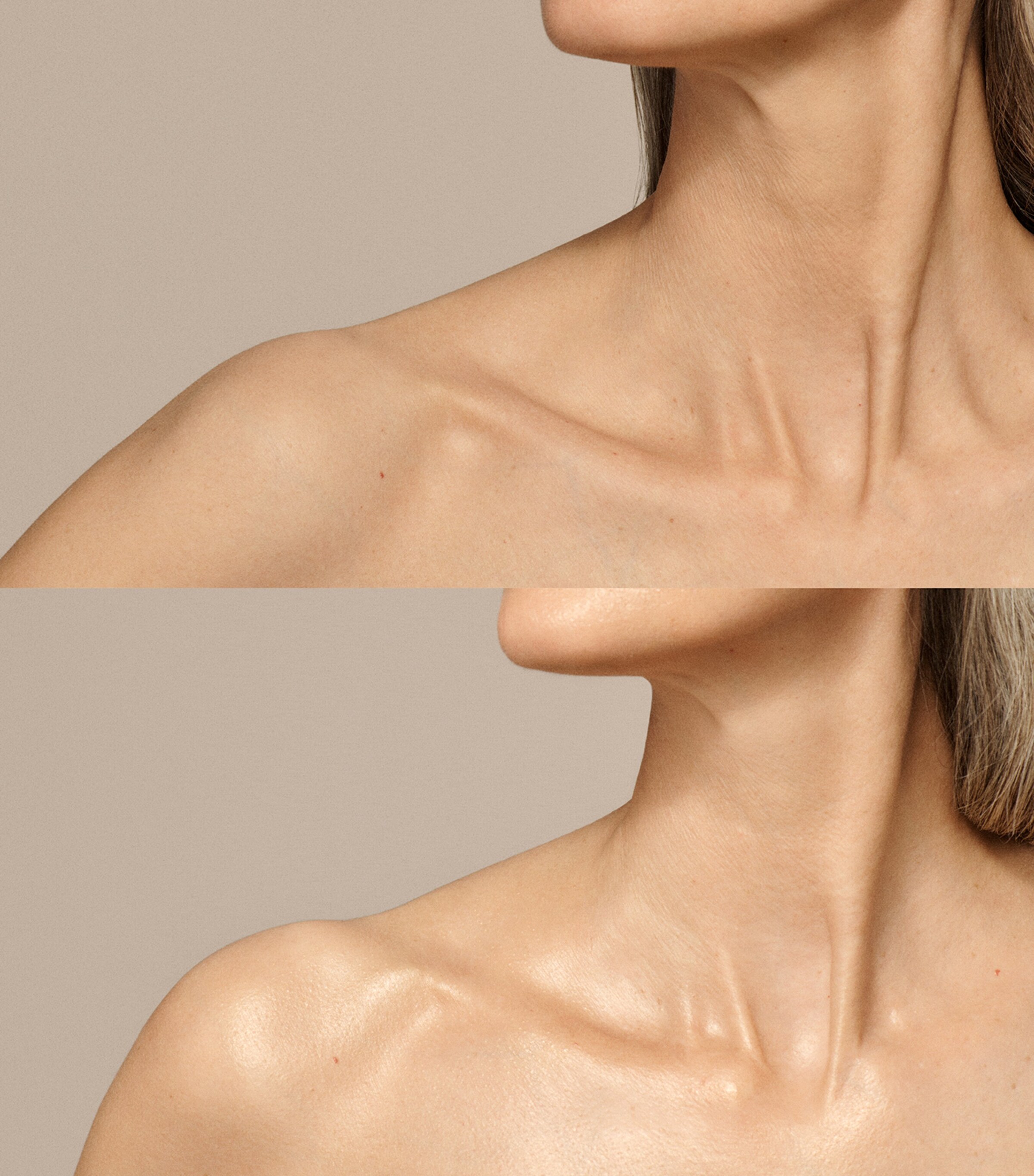 Skin Nova NO COLOUR Image 8