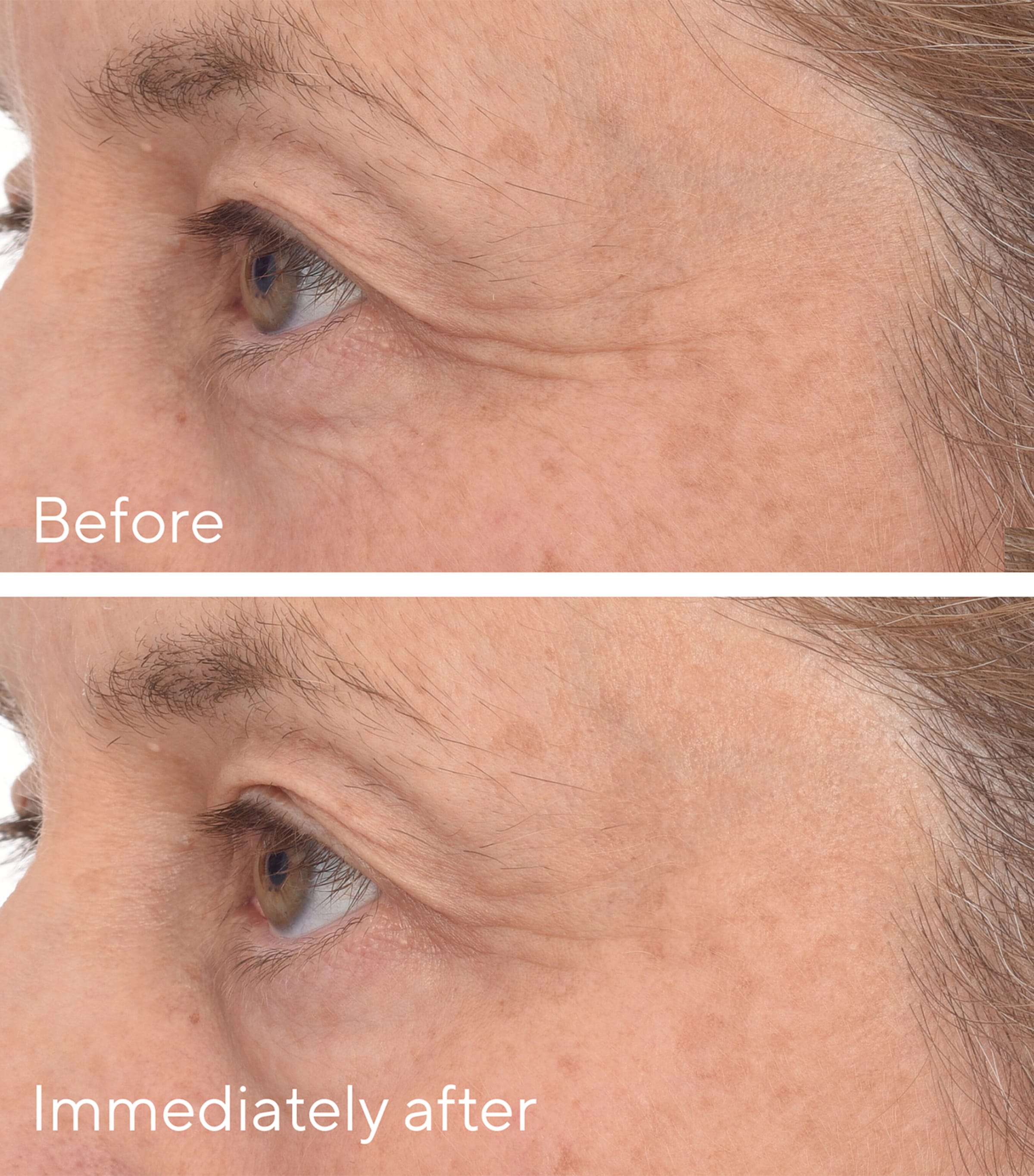 Retinol Youth Renewal Eye Mask (Pack of 5) NO COLOUR Image 4