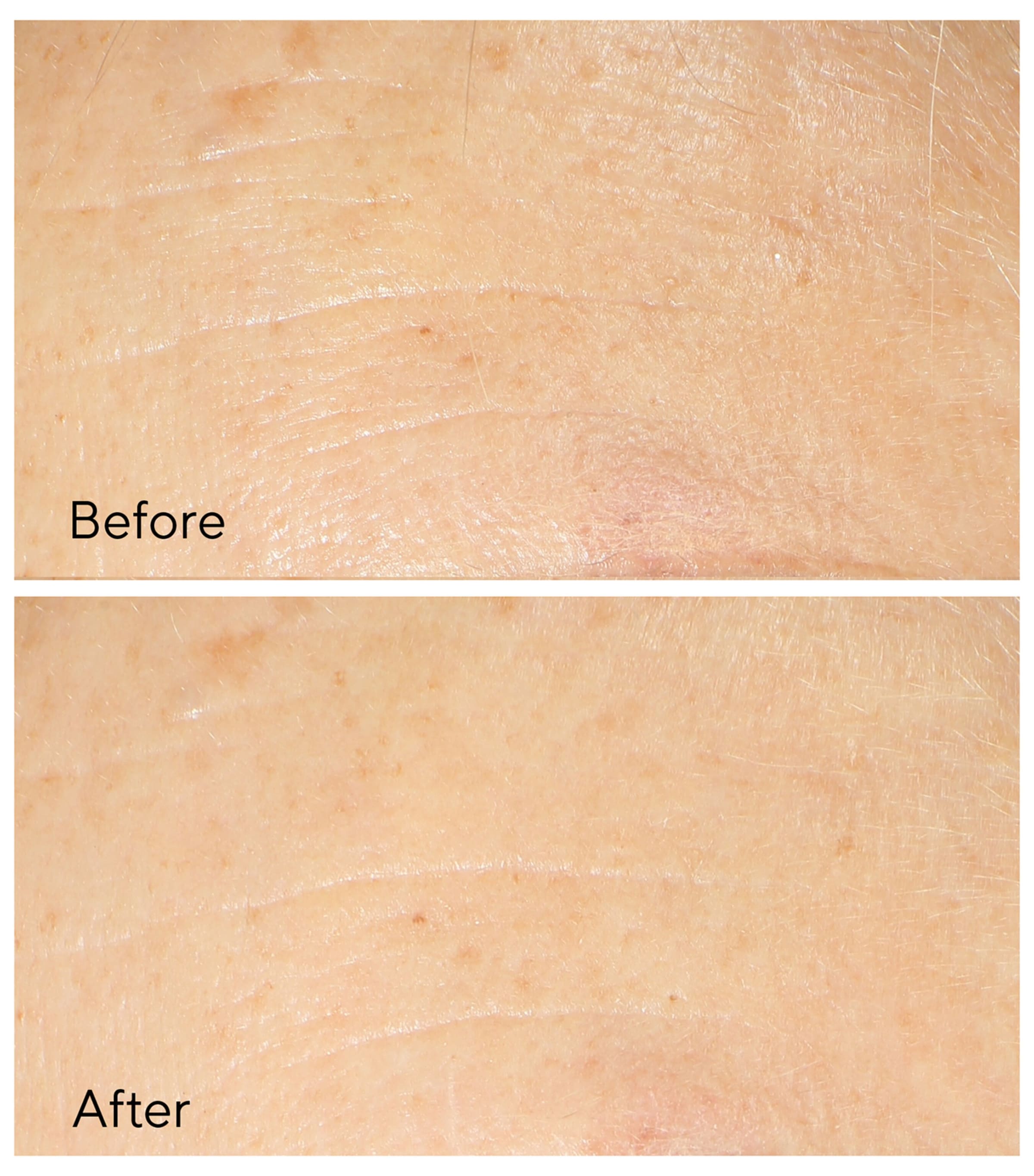 Retinol Youth Renewal Night Cream (50ml) NO COLOUR Image 2