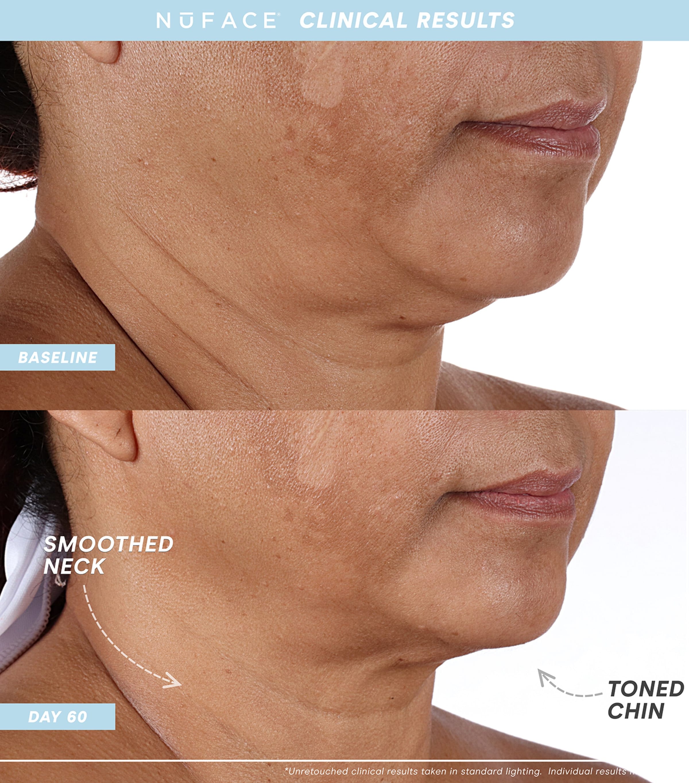 Trinity+ Starter Kit NO COLOUR Image 2