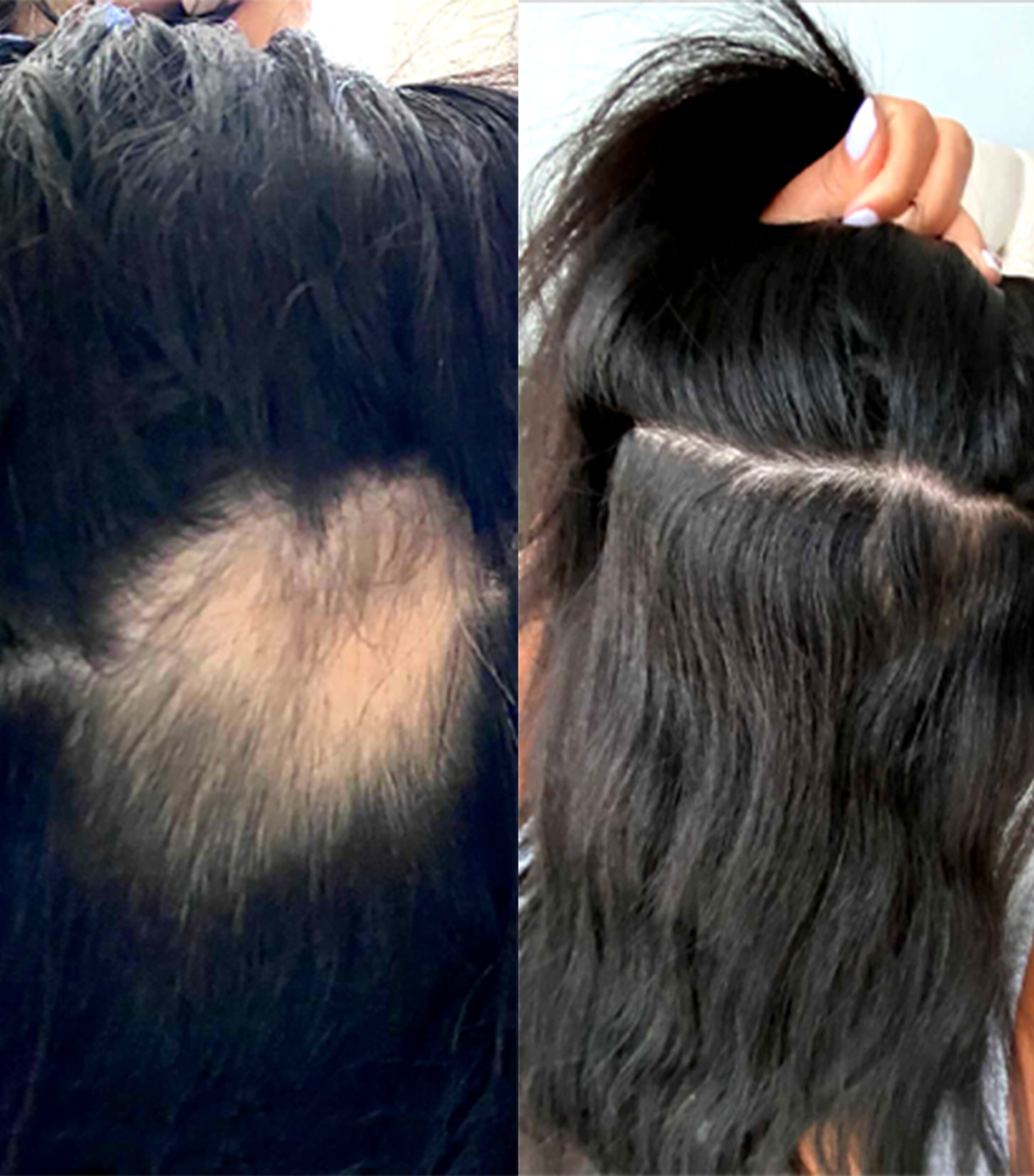 Gummy Stars (60 Gummies) NO COLOUR Image 4