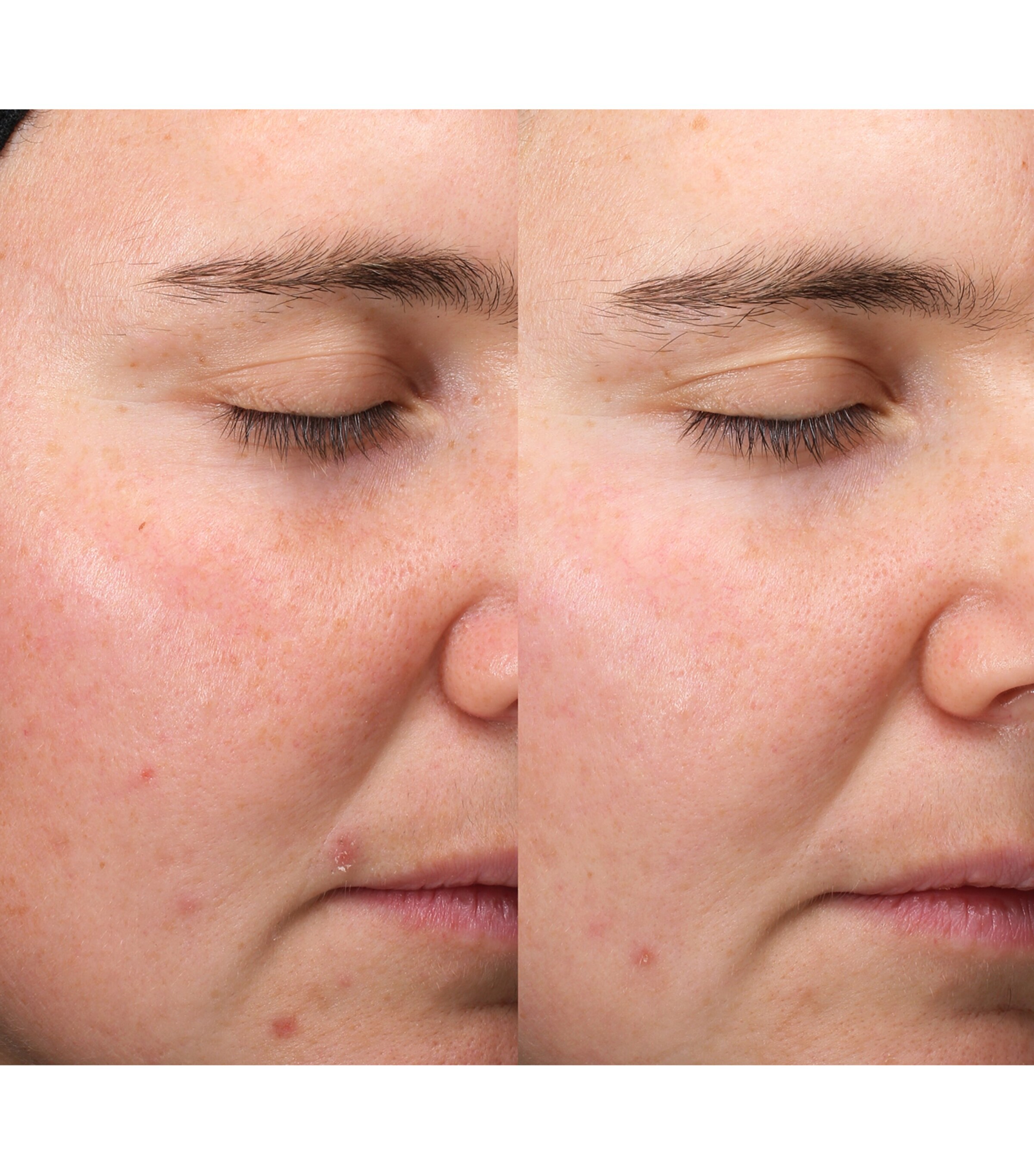 Exosome Hydro-Glow Complex Serum (30ml) NO COLOUR Image 4