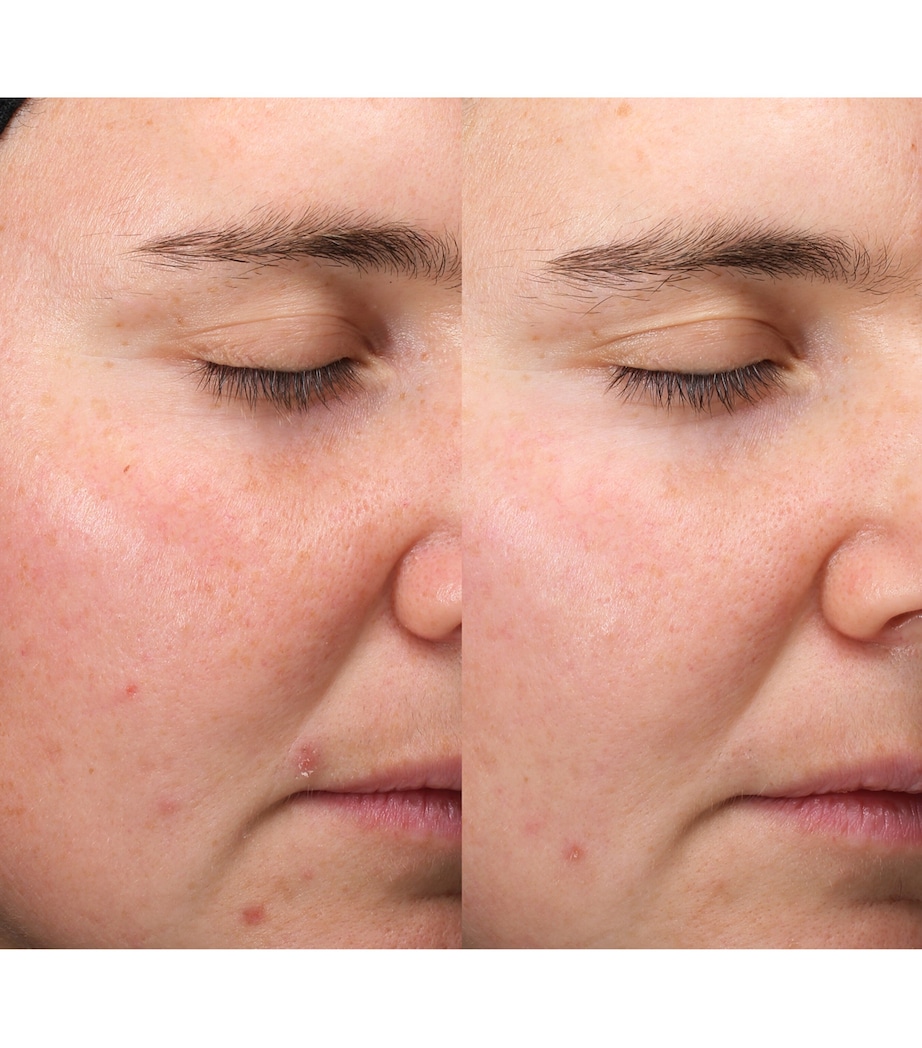 Exosome Hydro-Glow Complex Serum (30ml) NO COLOUR Image 4