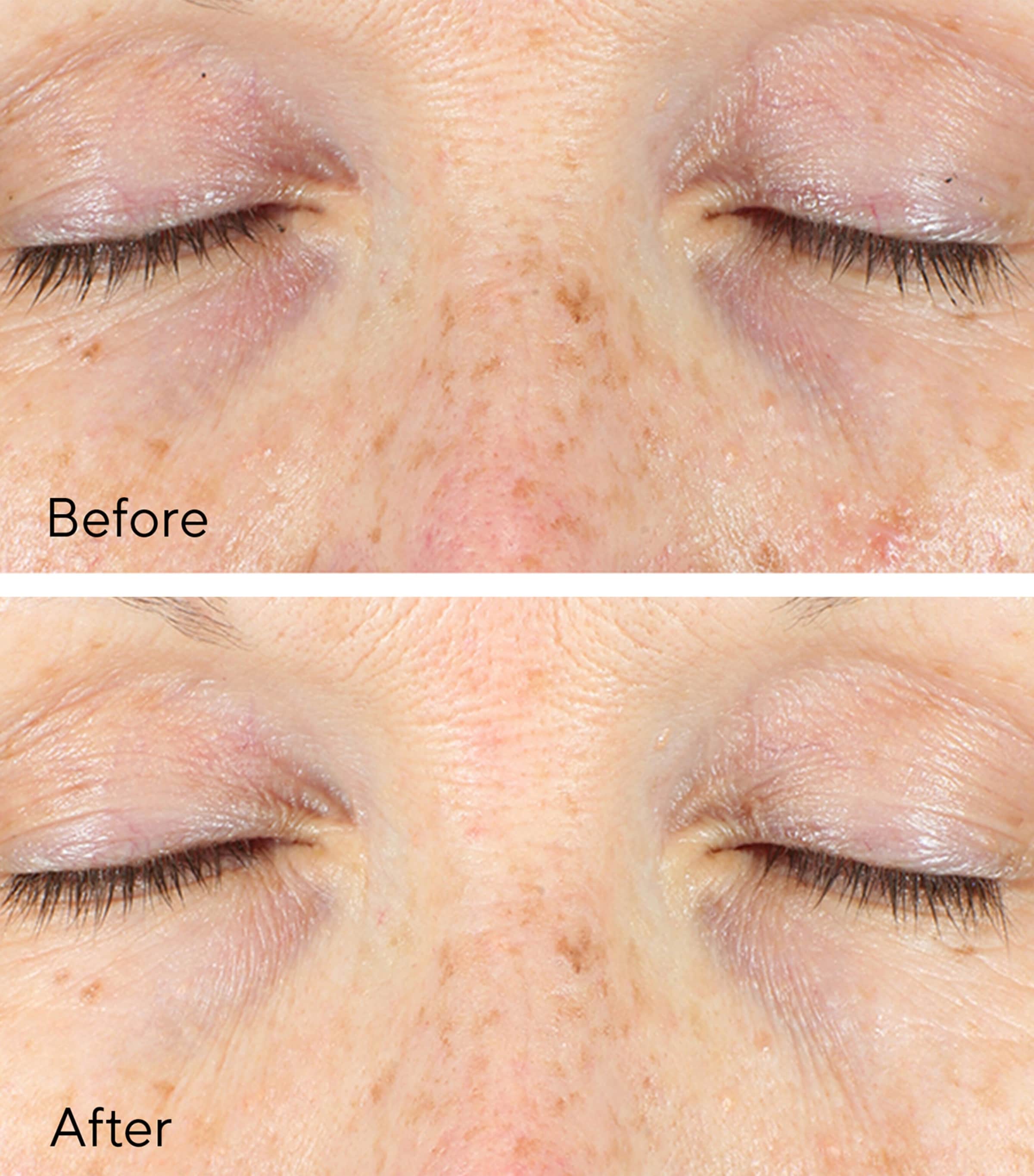 Vita-C Eyes Dark Circle Corrector (15Ml) NO COLOUR Image 4