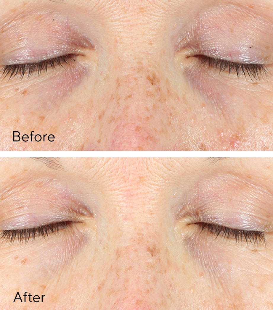 Vita-C Eyes Dark Circle Corrector (15Ml) NO COLOUR Image 4