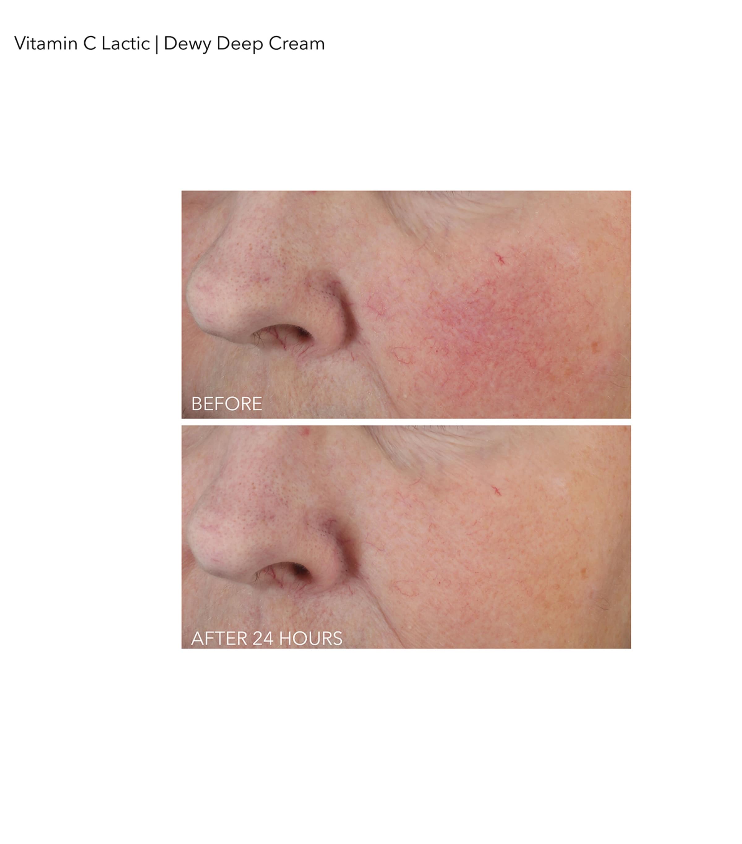 Vitamin C + Lactic Dewy Deep Cream (60ml) NO COLOUR Image 3