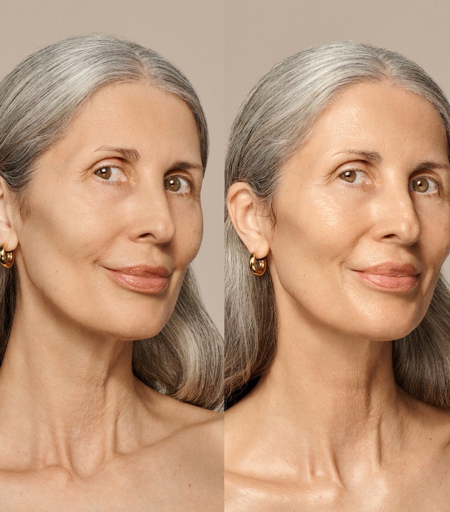 Skin Nova XL NO COLOUR Image 4