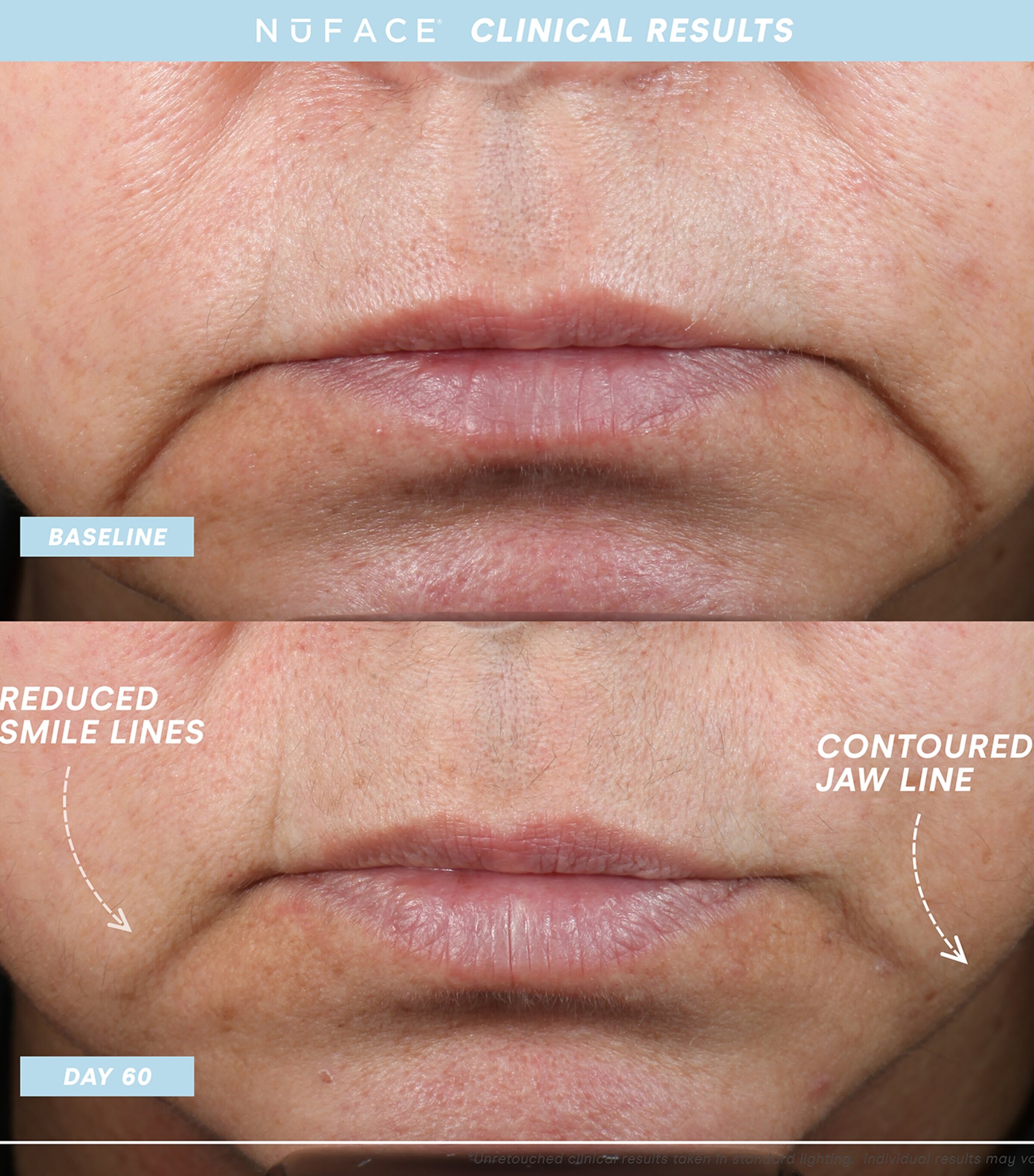 Mini+ Starter Kit NO COLOUR Image 4