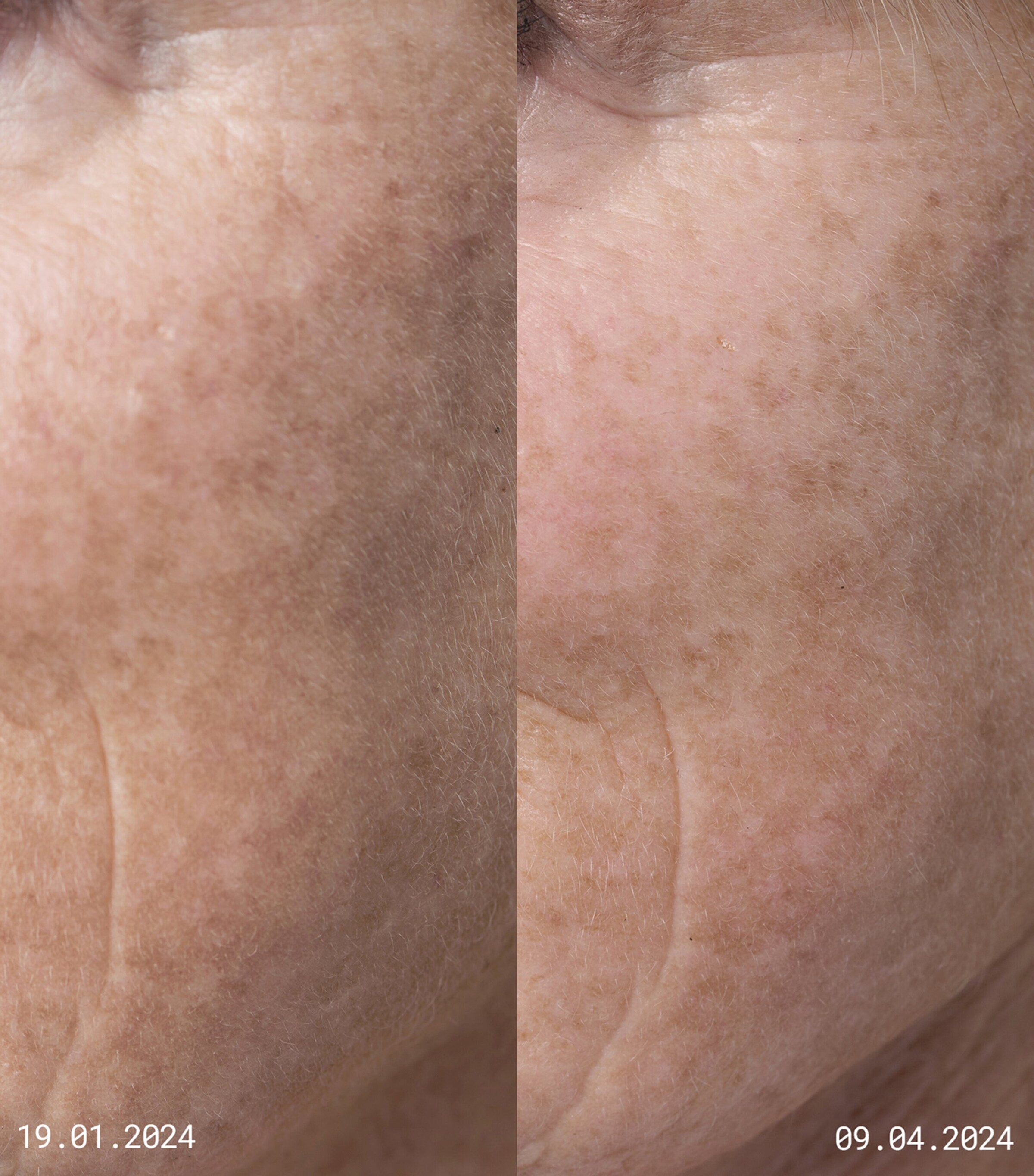 EMMA LEWISHAM Skin Reset Serum Refill (30ml) Image 3
