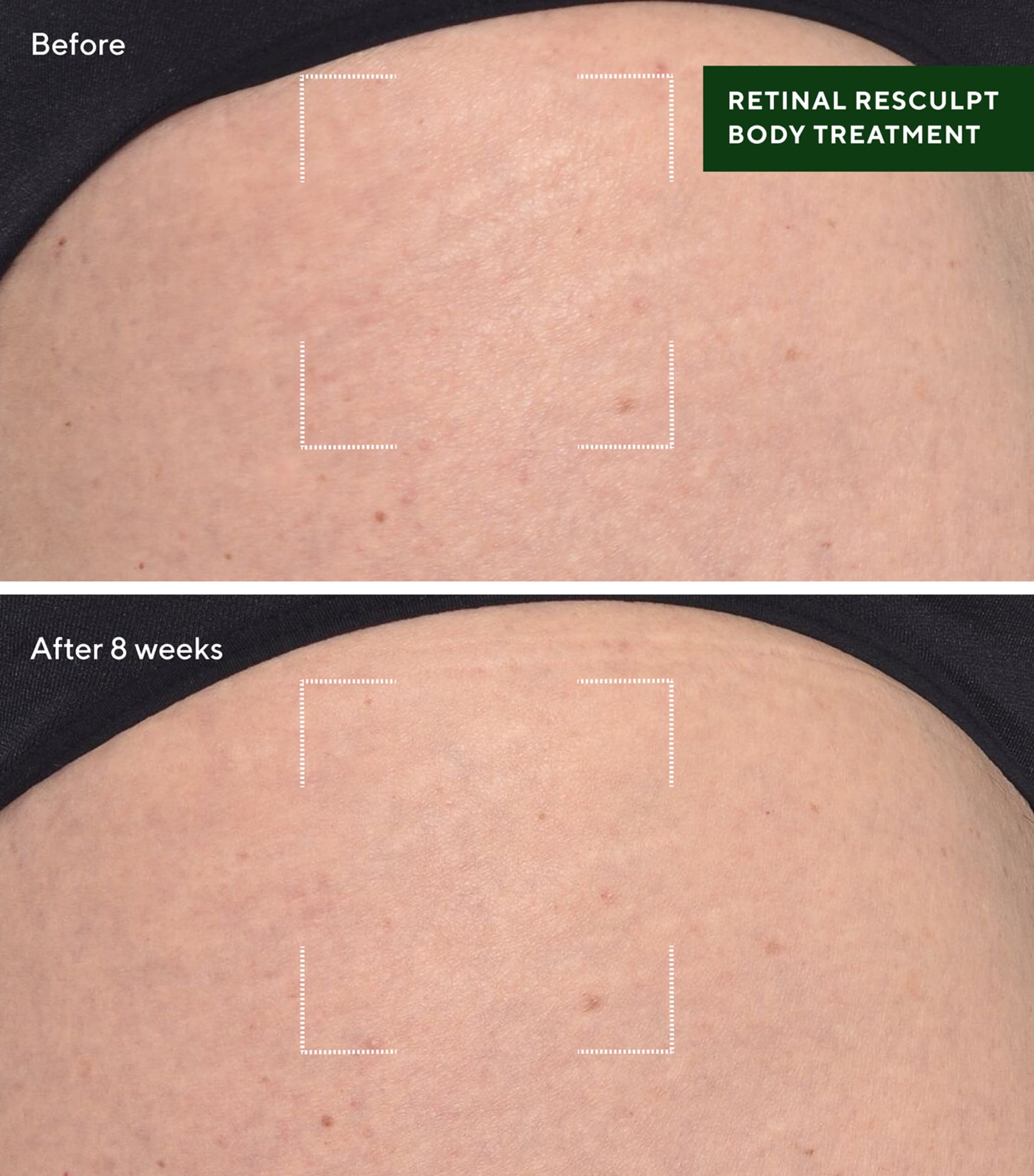 Retinal ReSculpt Body Treatment (148ml) RESURGENCE Image 4