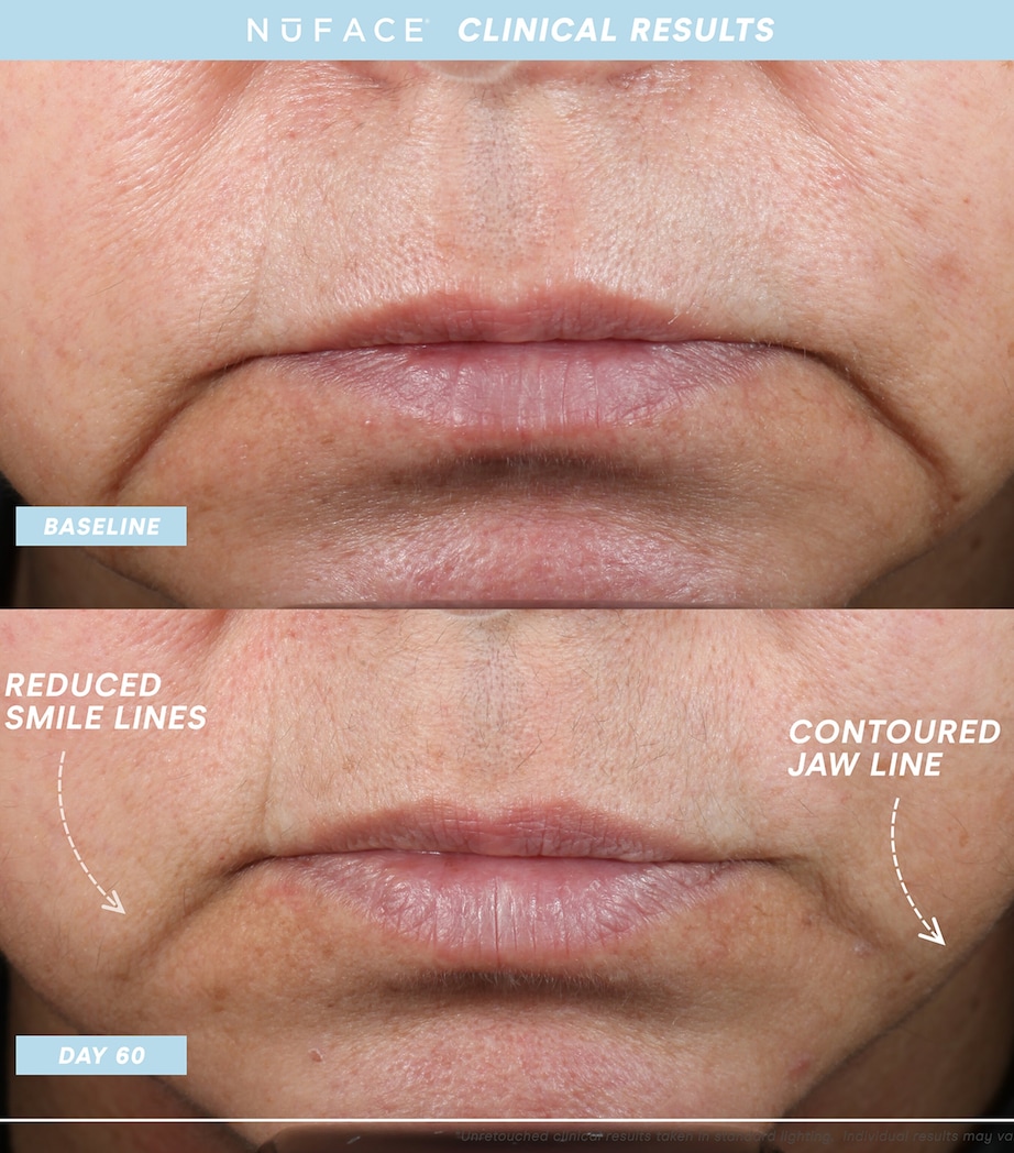 Trinity+ Starter Kit NO COLOUR Image 4