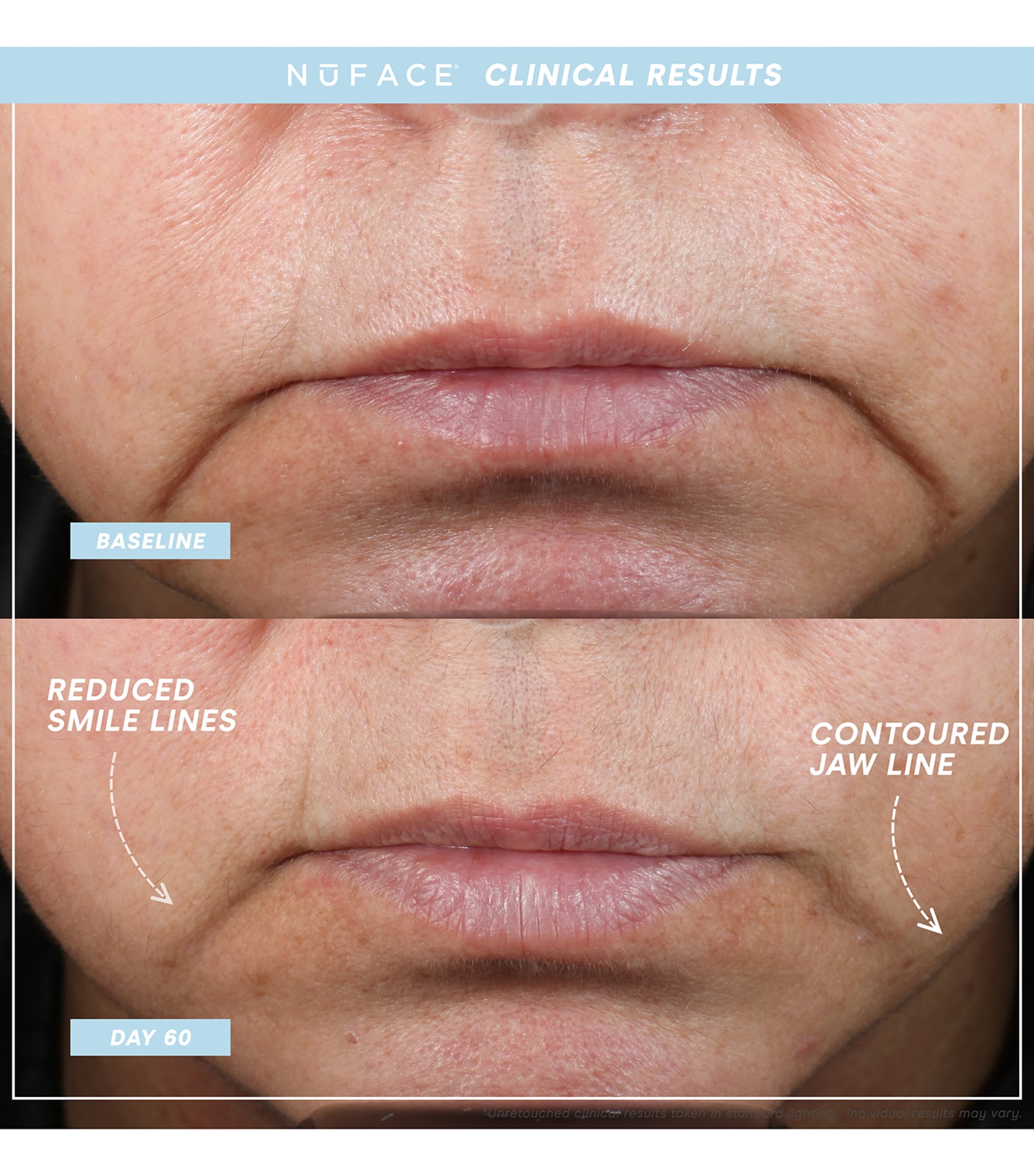 Mini+ Starter Kit NO COLOUR Image 4