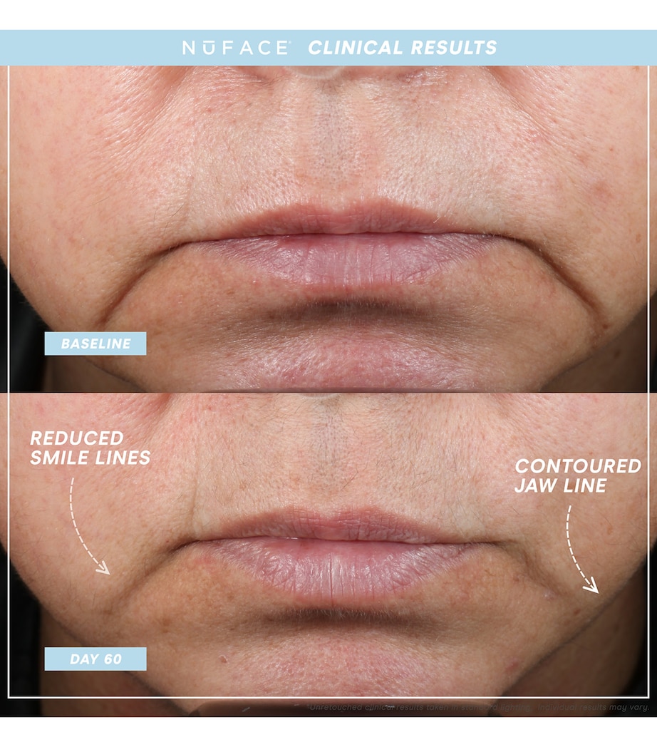 Mini+ Starter Kit NO COLOUR Image 4