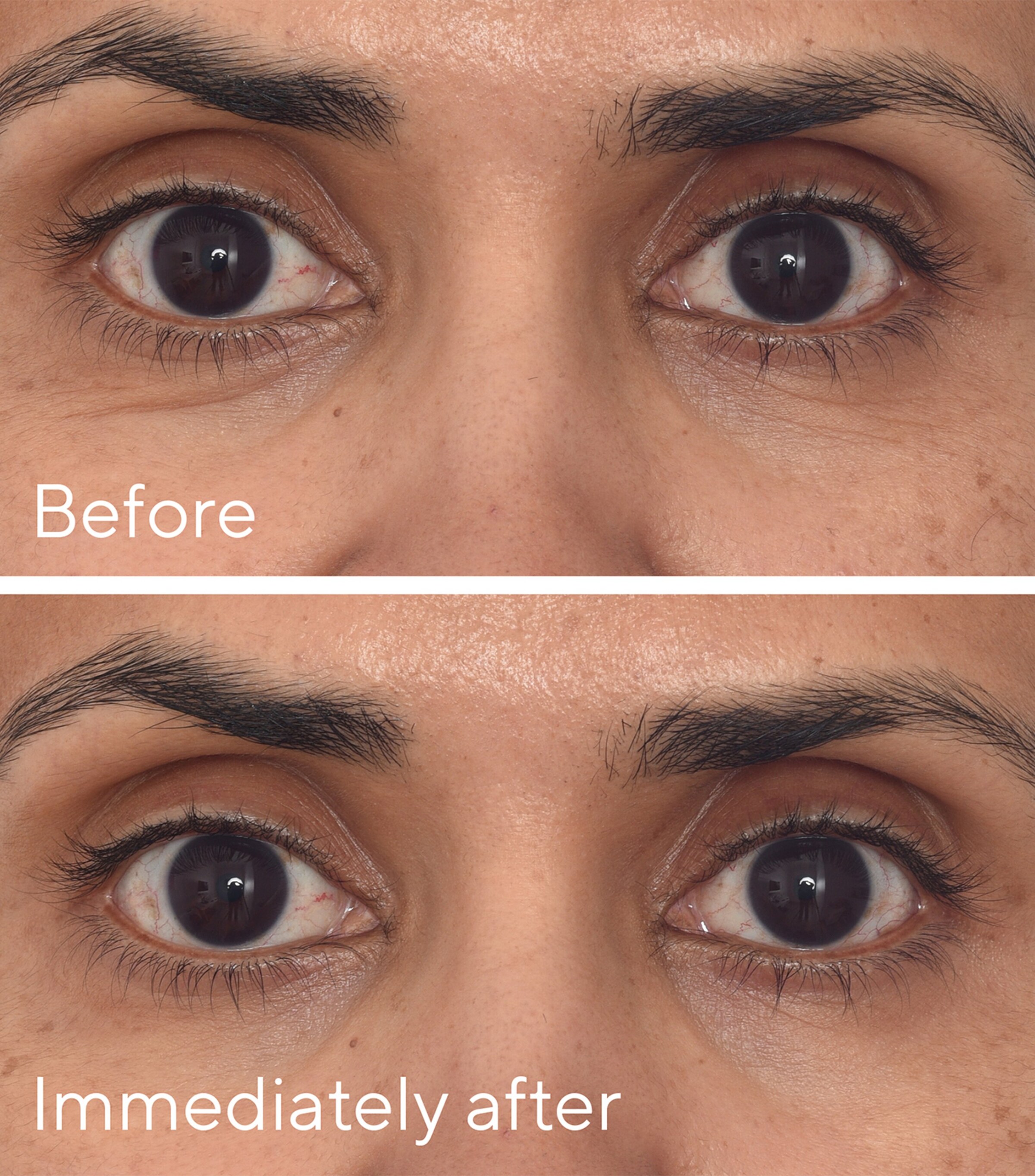 Retinol Youth Renewal Eye Mask (Pack of 5) NO COLOUR Image 3