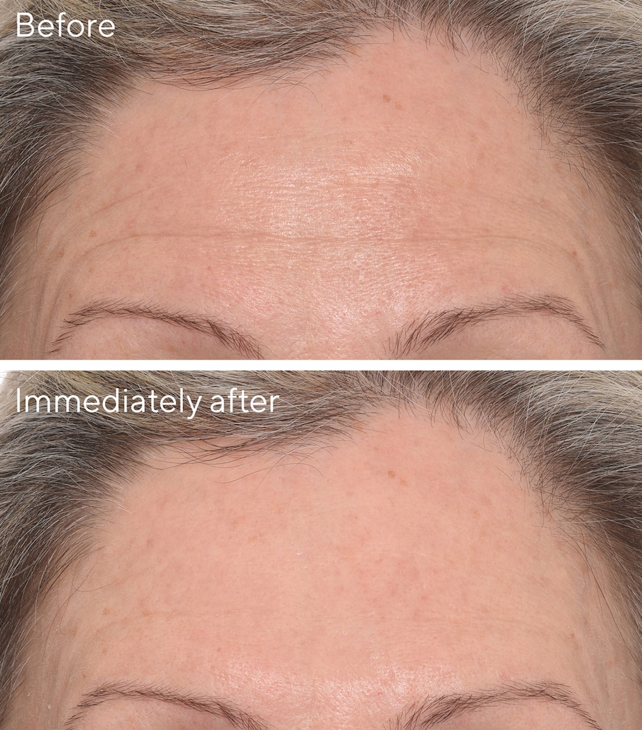 Targeted Wrinkle Corrector (15ml) NO COLOUR Image 2