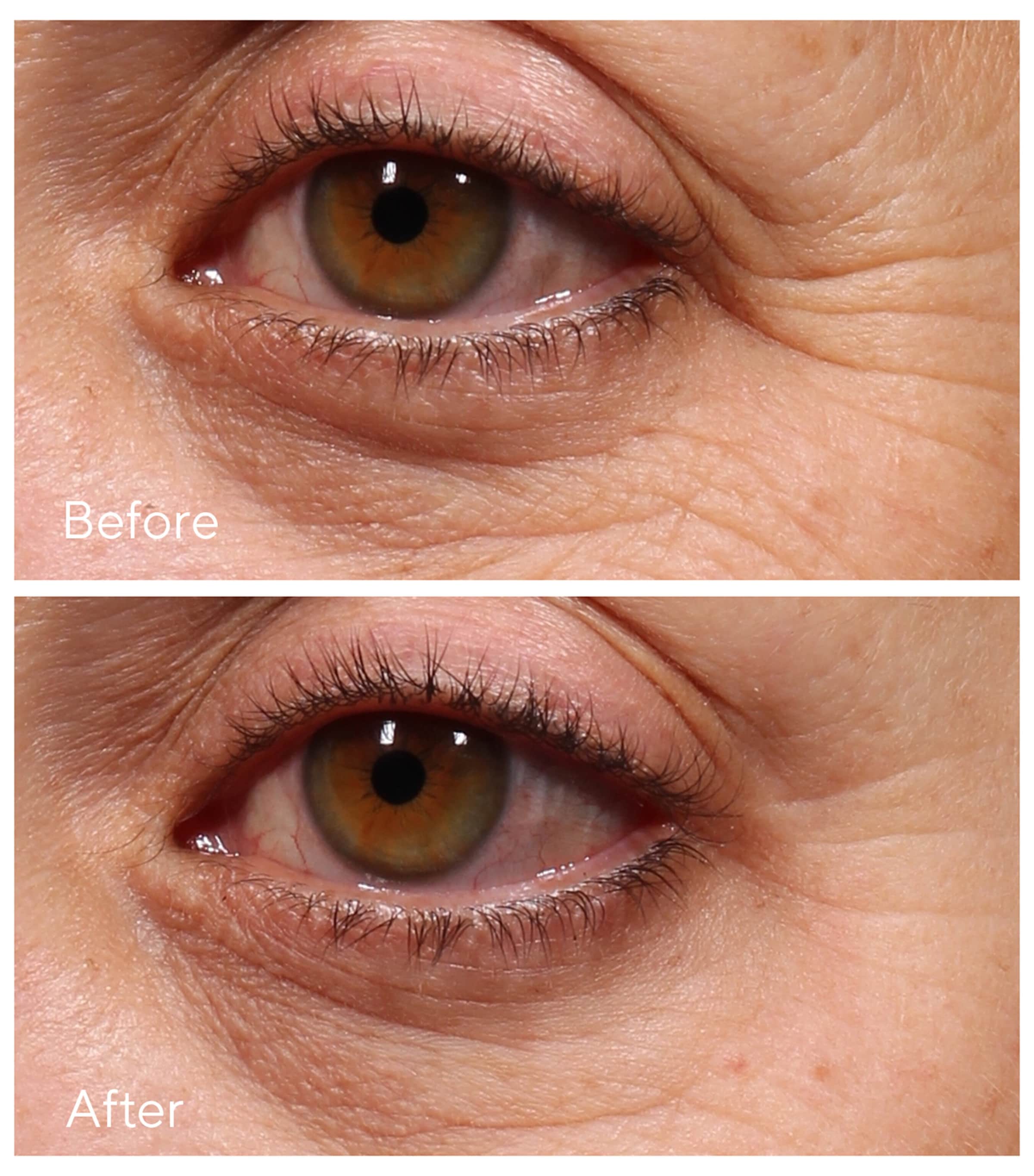 Retinol Youth Renewal Eye Serum (15ml) NO COLOUR Image 2