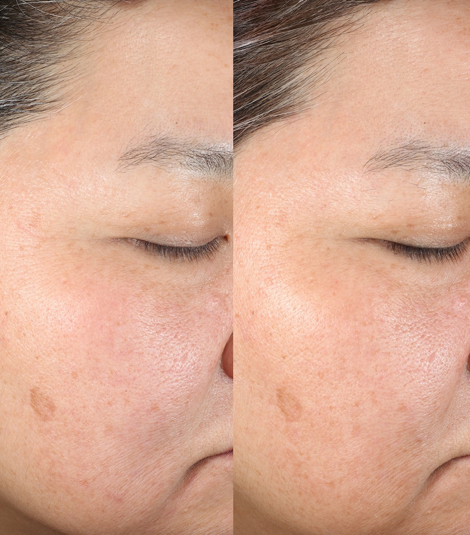 PMD Clean Redvolution NO COLOUR Image 3