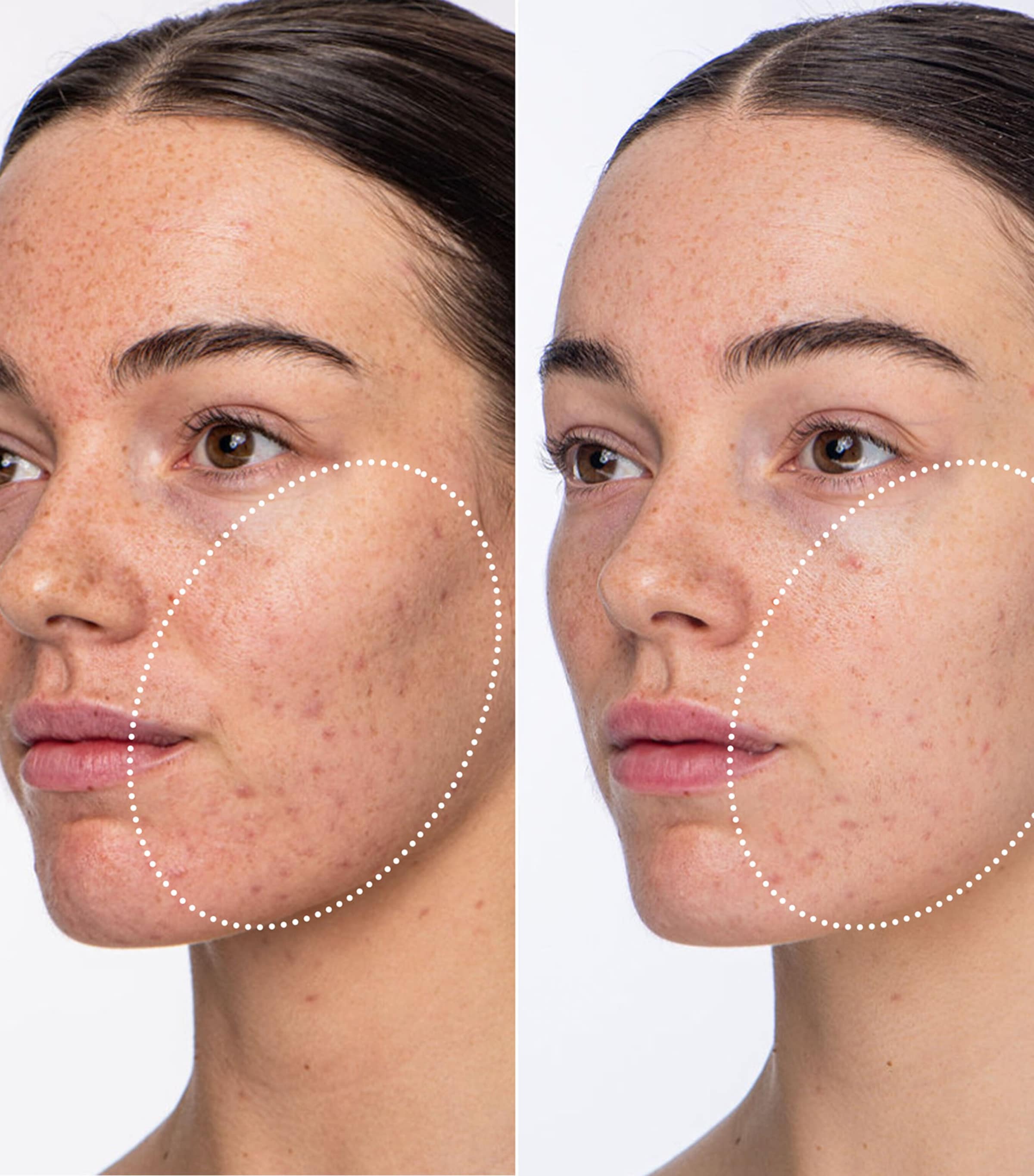 Detox Darling Microbiome Balancing Toner + Essence (50ml) NO COLOUR Image 3