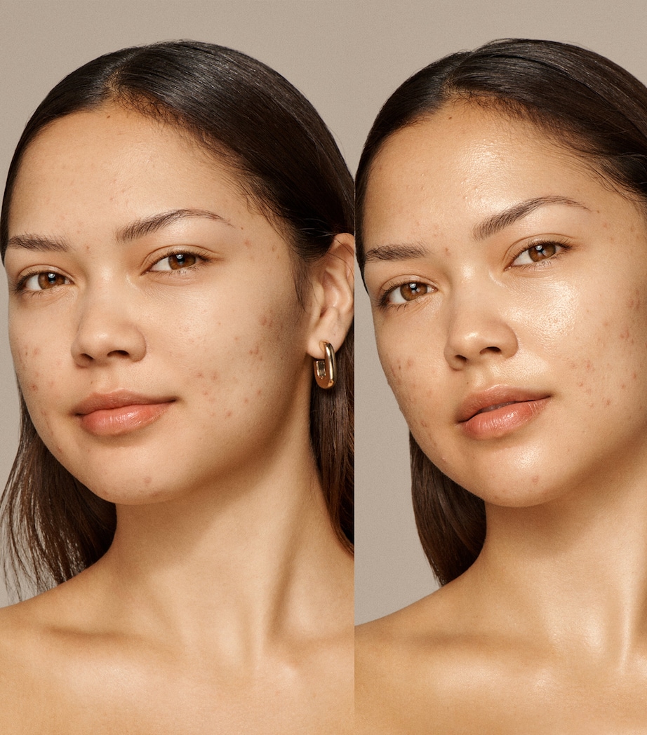 Skin Nova XL NO COLOUR Image 5