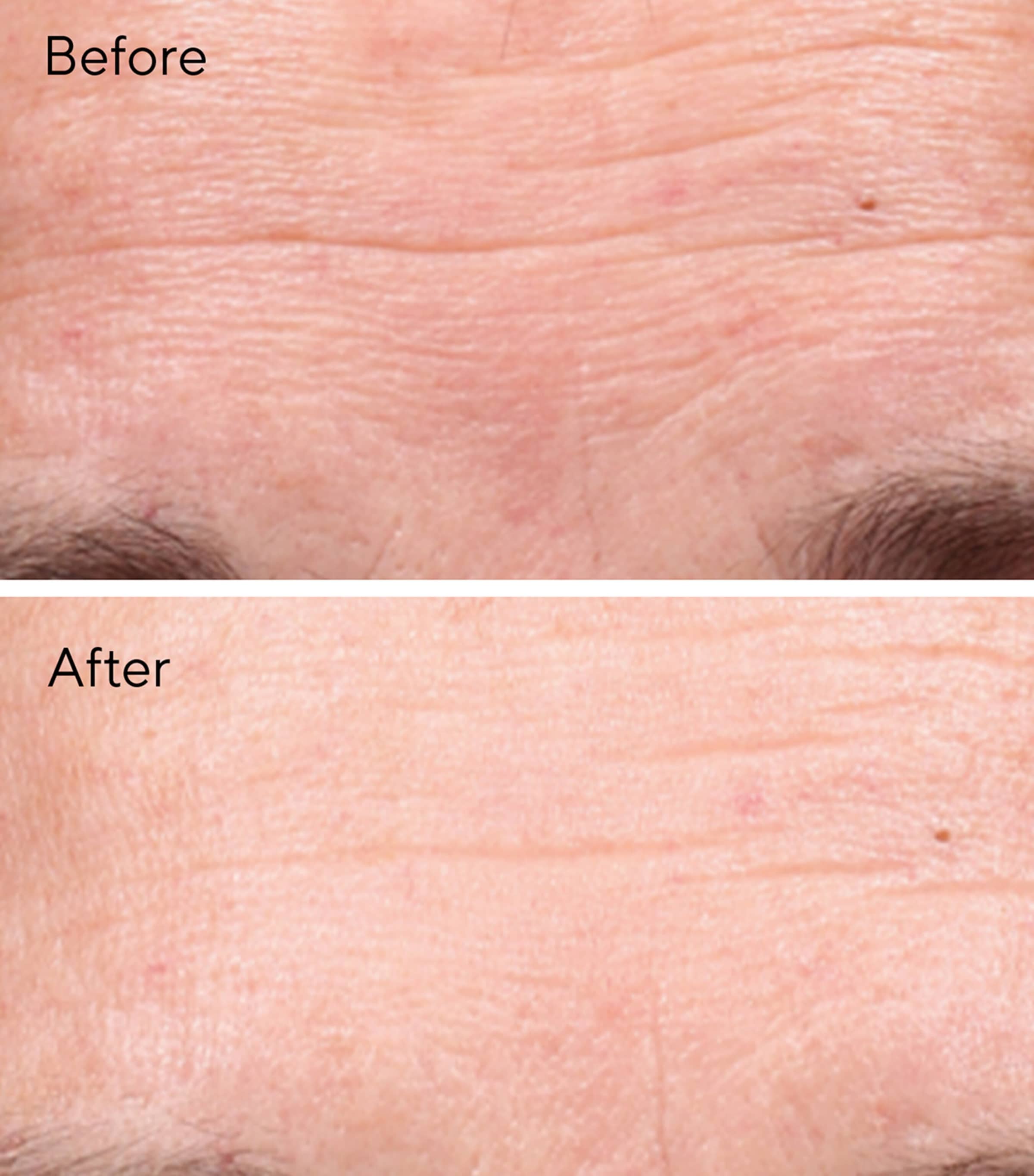 Retinol Youth Renewal Serum (30ml) NO COLOUR Image 2