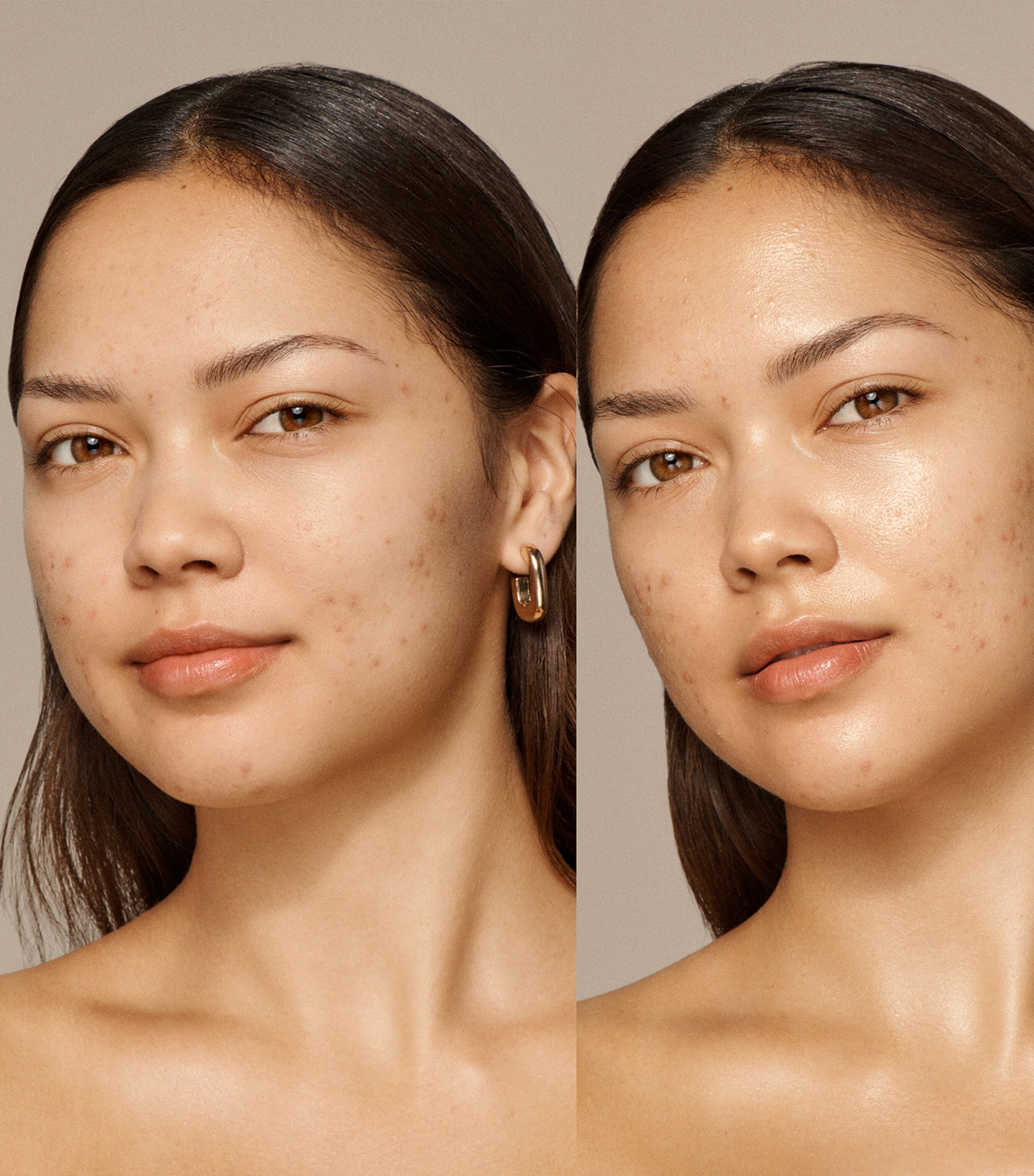 Skin Nova NO COLOUR Image 5