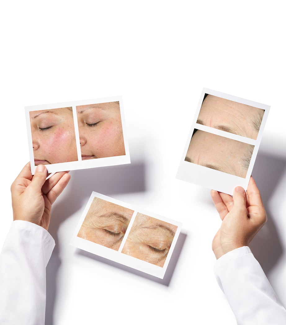 Intense Recovery Cream (50ml) NO COLOUR Image 3