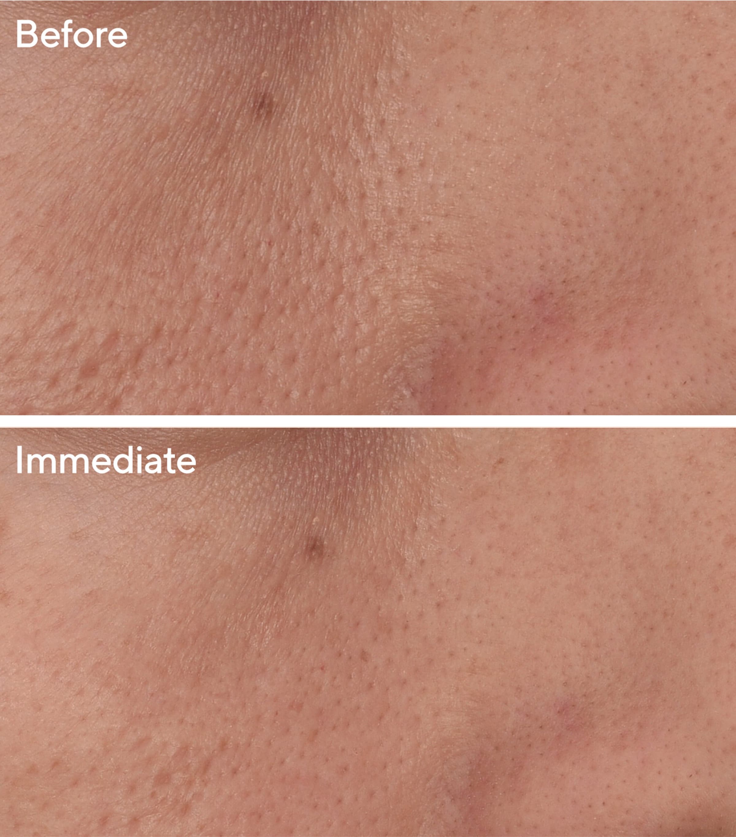 Targeted Pore Corrector (15ml) NO COLOUR Image 2