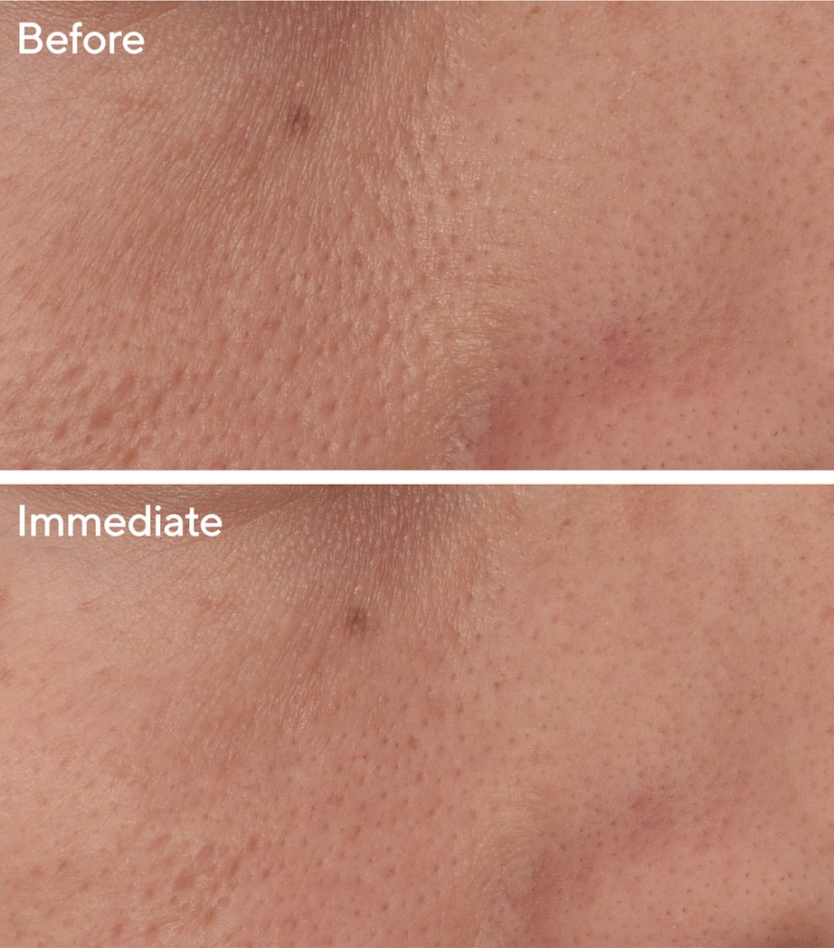 Targeted Pore Corrector (15ml) NO COLOUR Image 2