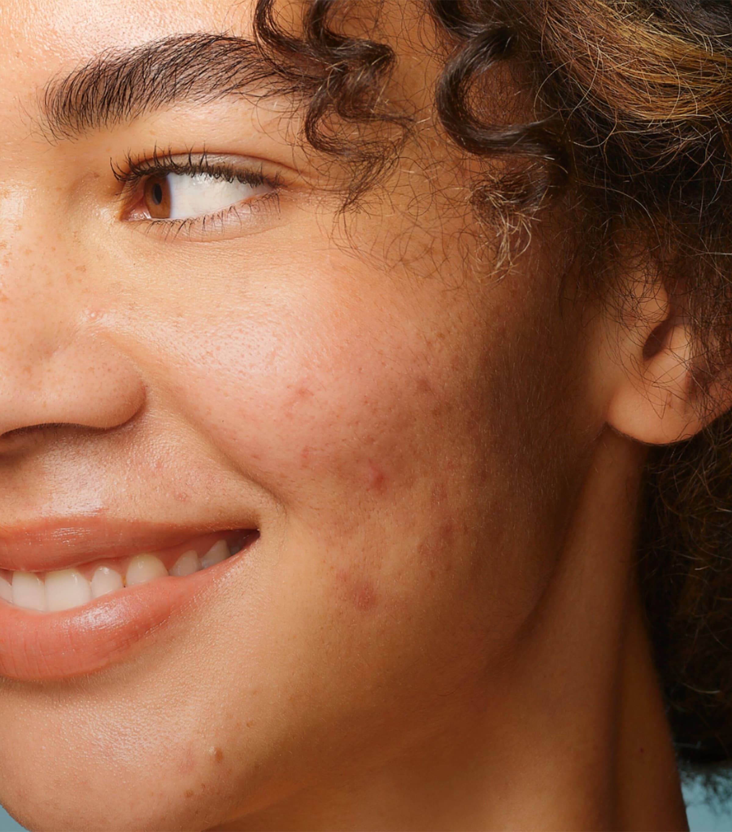 Biome-Balancing Clear & Prevent Blemish Treatment Serum (30ml) NO COLOUR Image 2