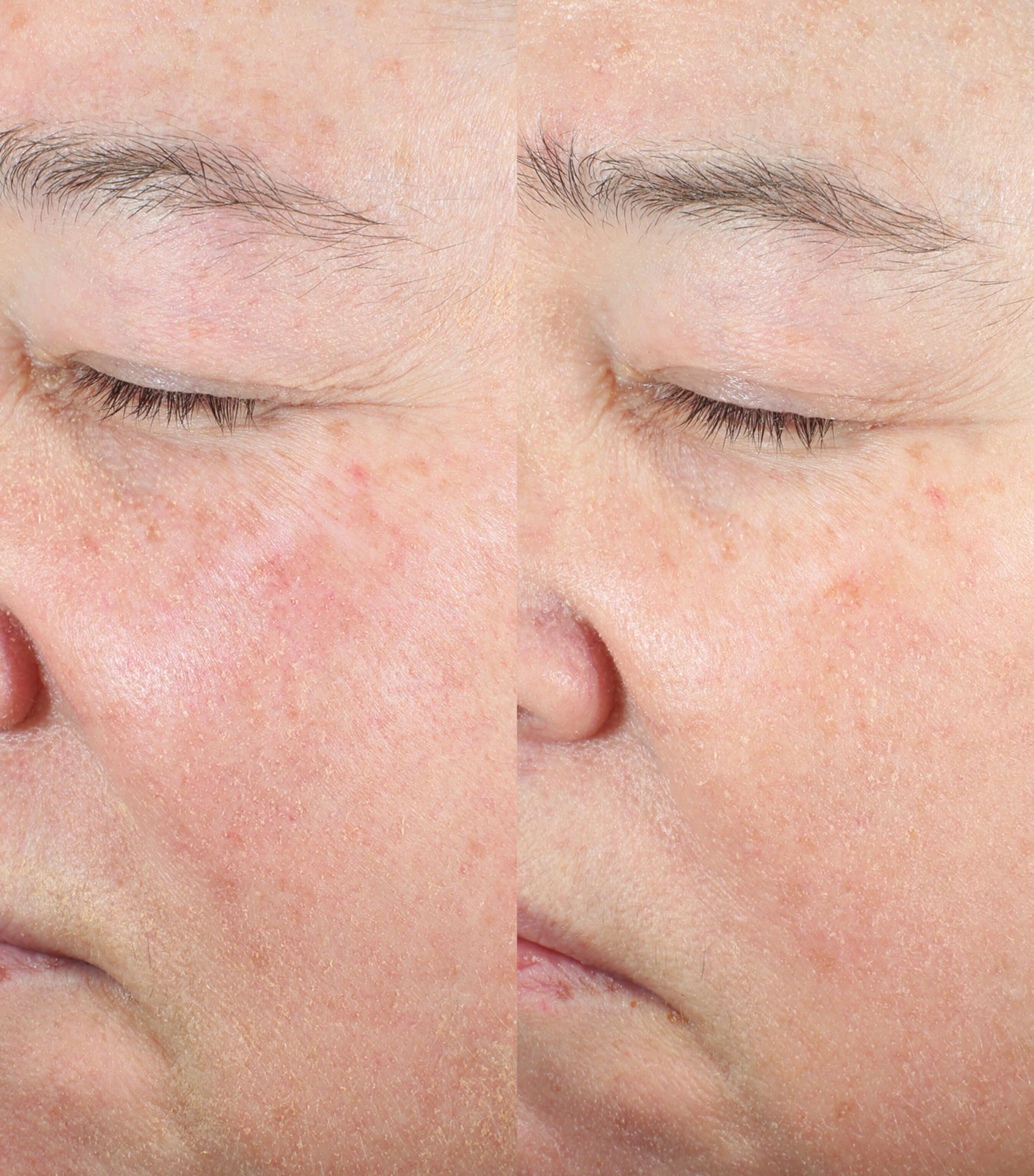 Ranavat Restoring Moonseed Treatment (50ml) Image 2
