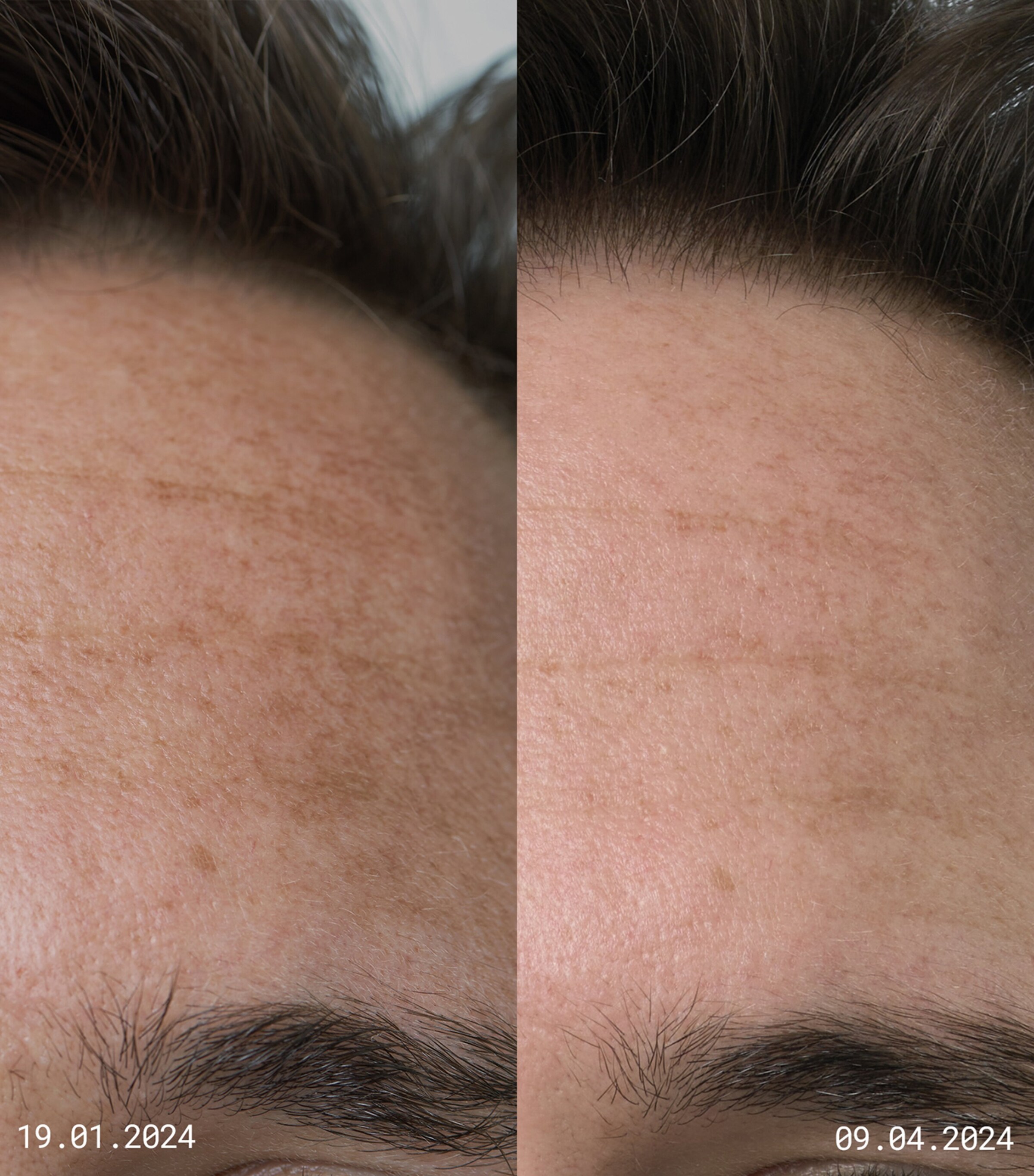 EMMA LEWISHAM Skin Reset Serum Refill (30ml) Image 4